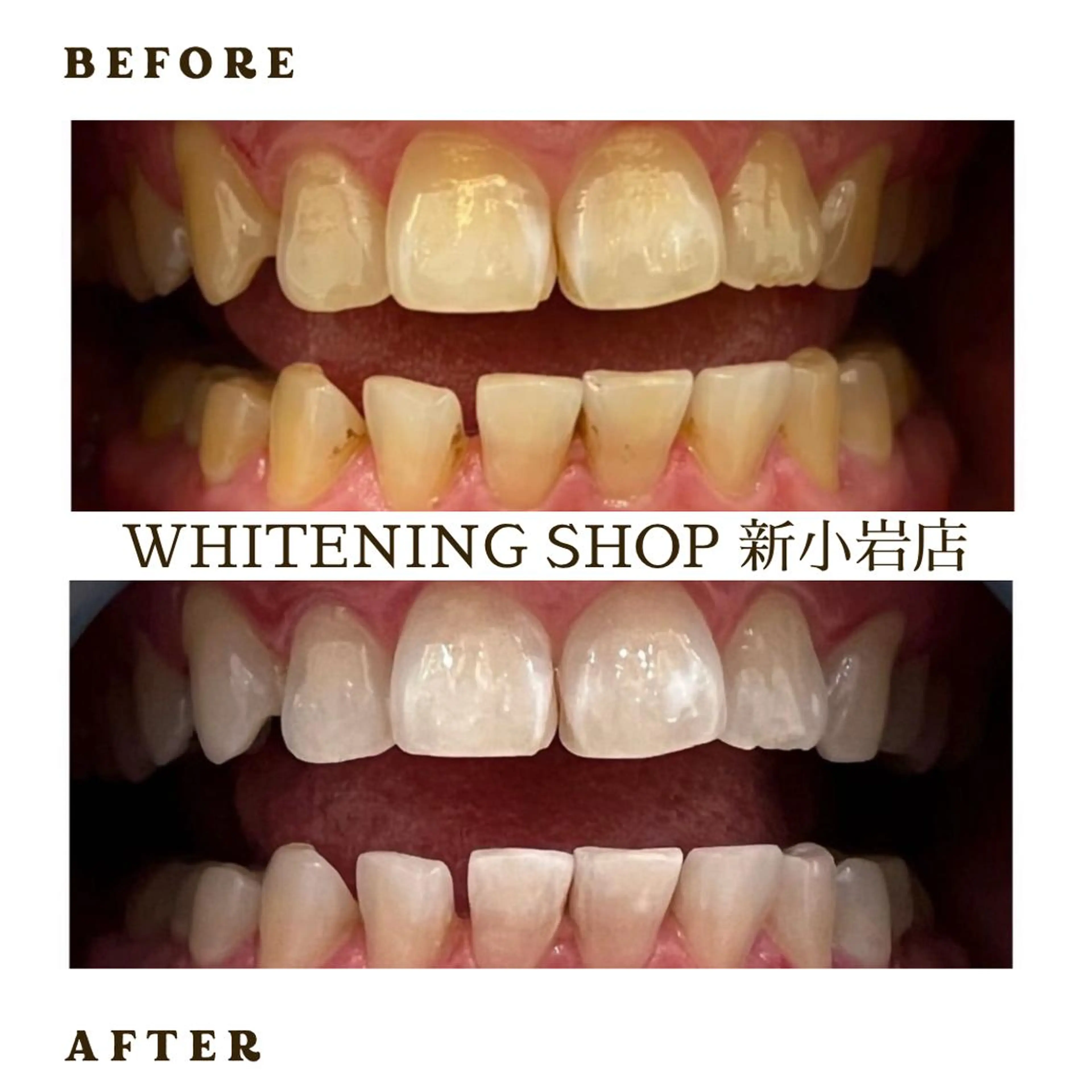 メンズ その他 ホワイトニング ショップ新小岩店のその他イメージ