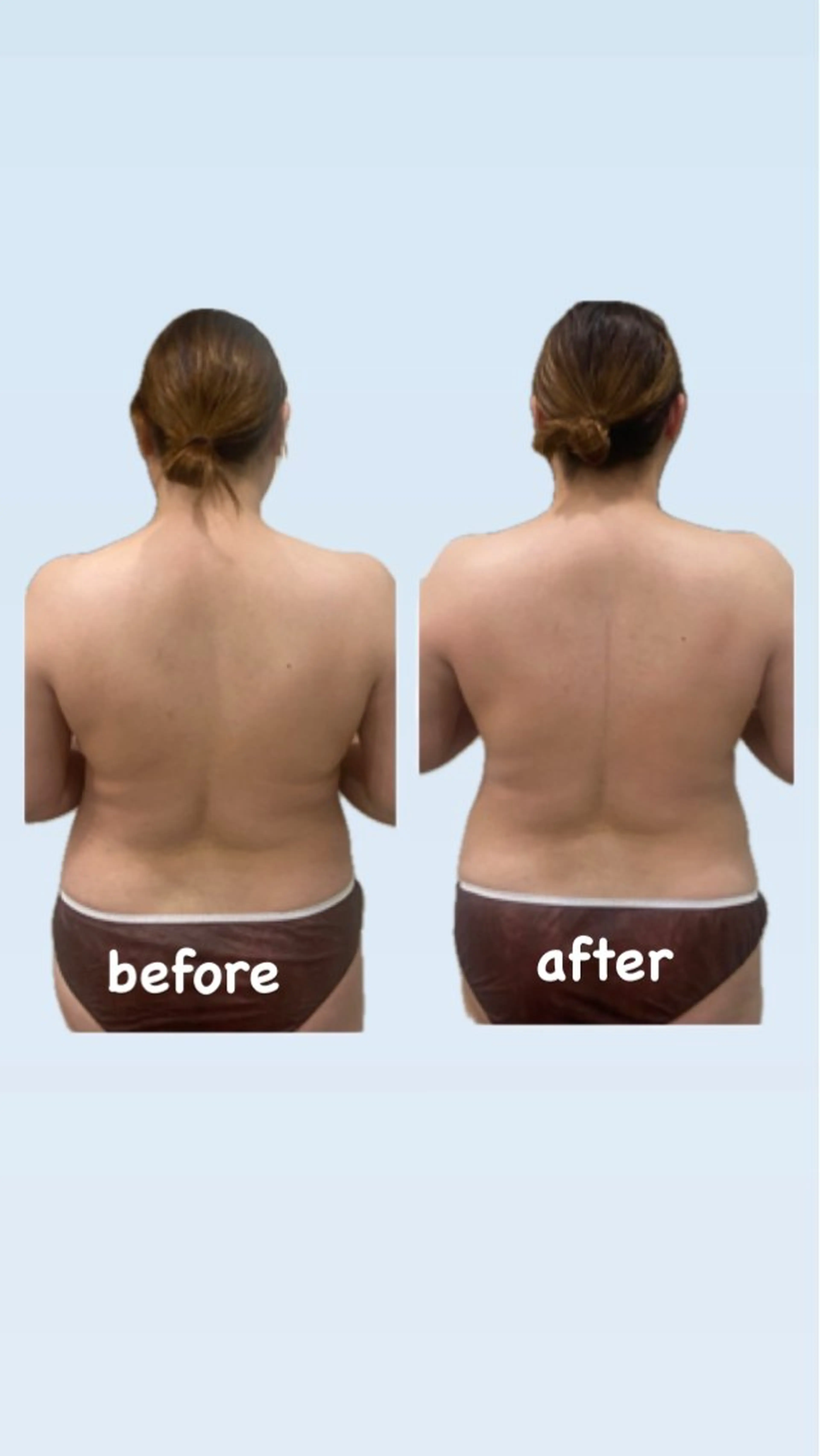 エステ エステティックサロン YouMeのエステ・リラクイメージ