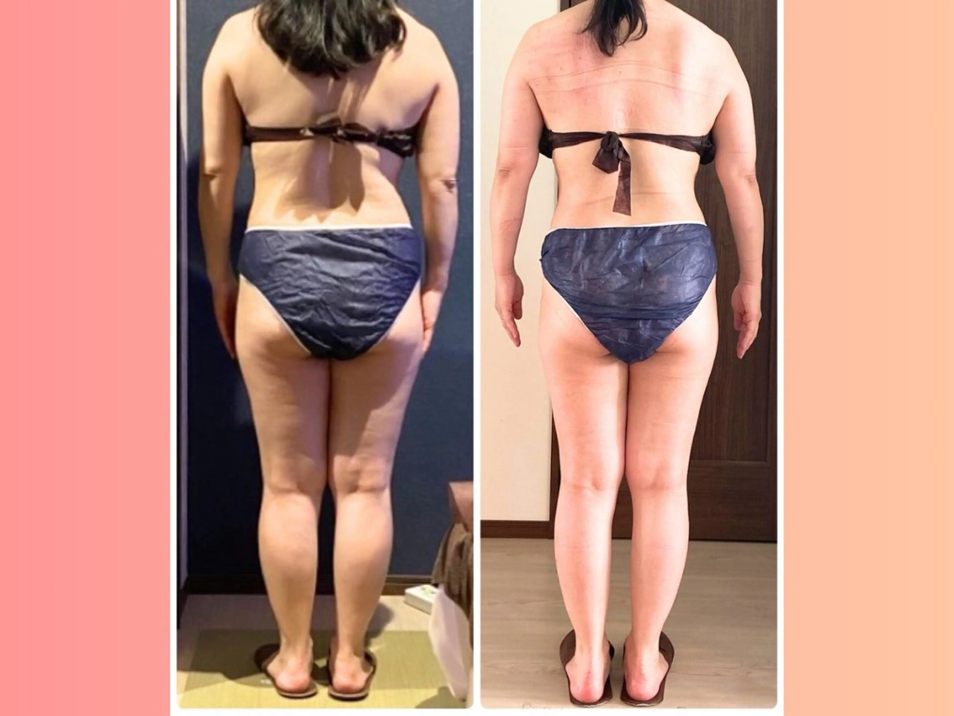 人気No.1【短期集中ケア】フルオーダーメイド痩身!全身120分 26400円→12100円の写真