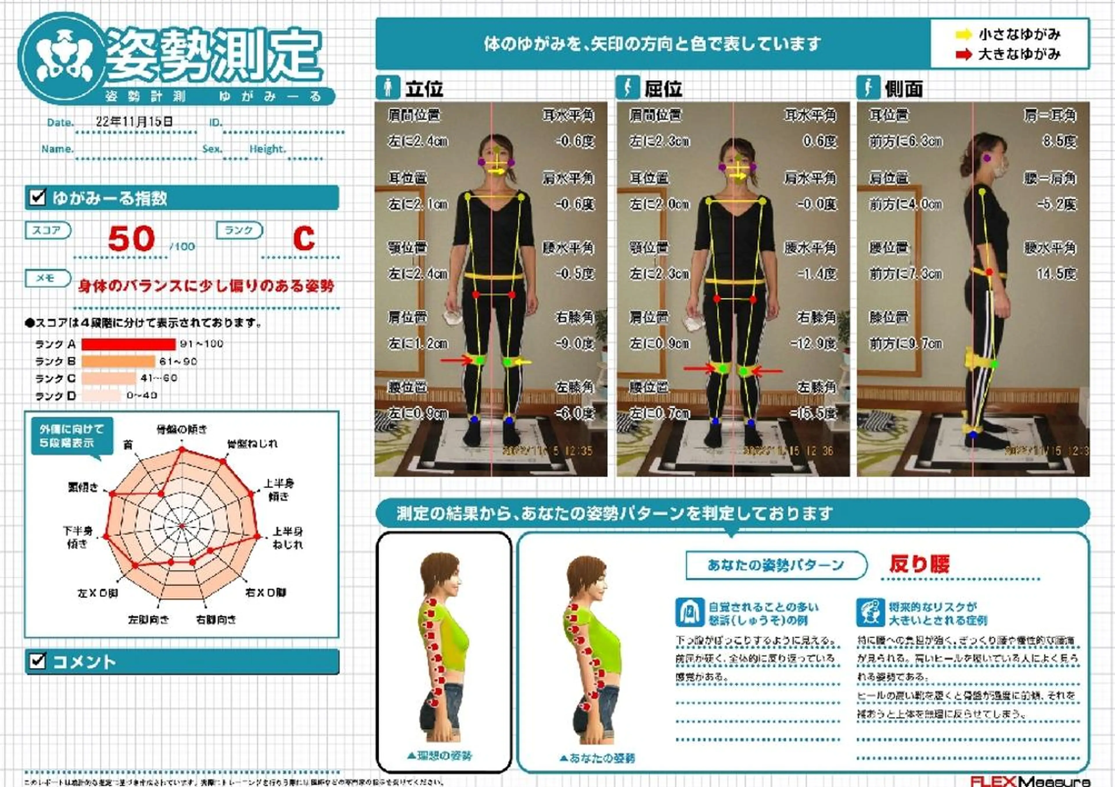 通常オプション【IT姿勢・筋肉診断】15分の写真