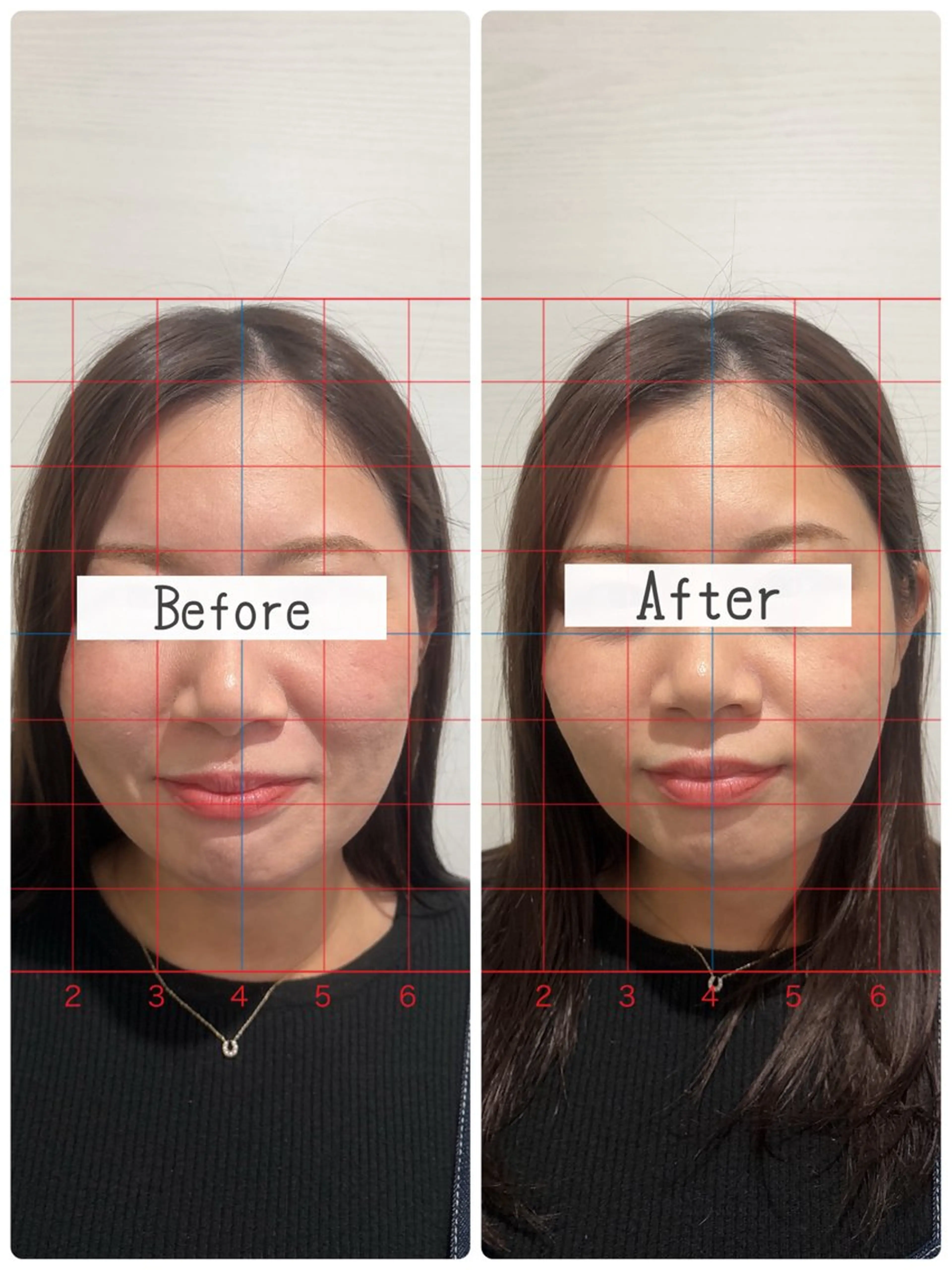 エステ リラク salon  Stellum所属・Stellum 小顔矯正&ヘッドスパのエステ・リラクイメージ