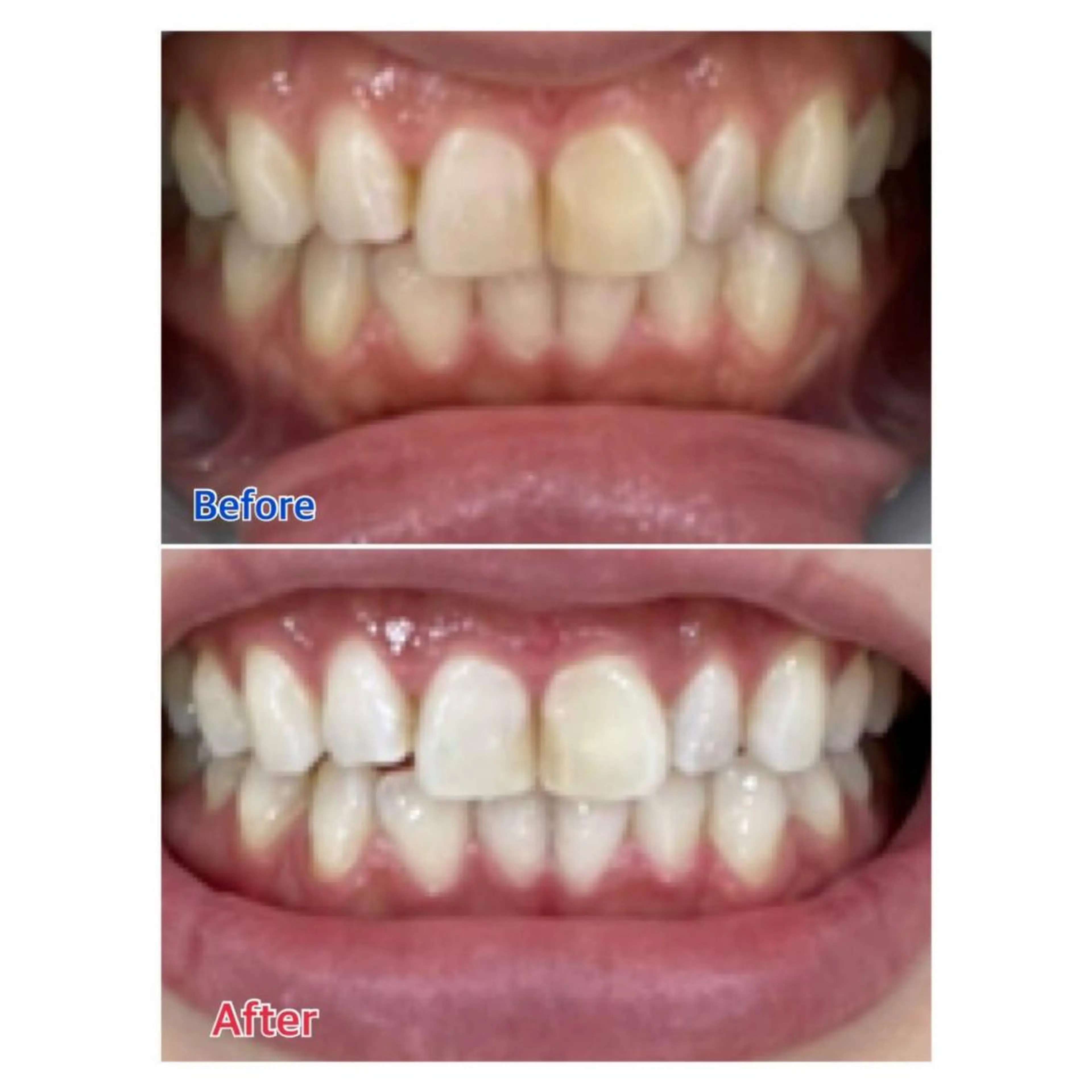 MBEAUTYSALON 千葉店・京成大久保所属・Melty 輝のその他イメージ