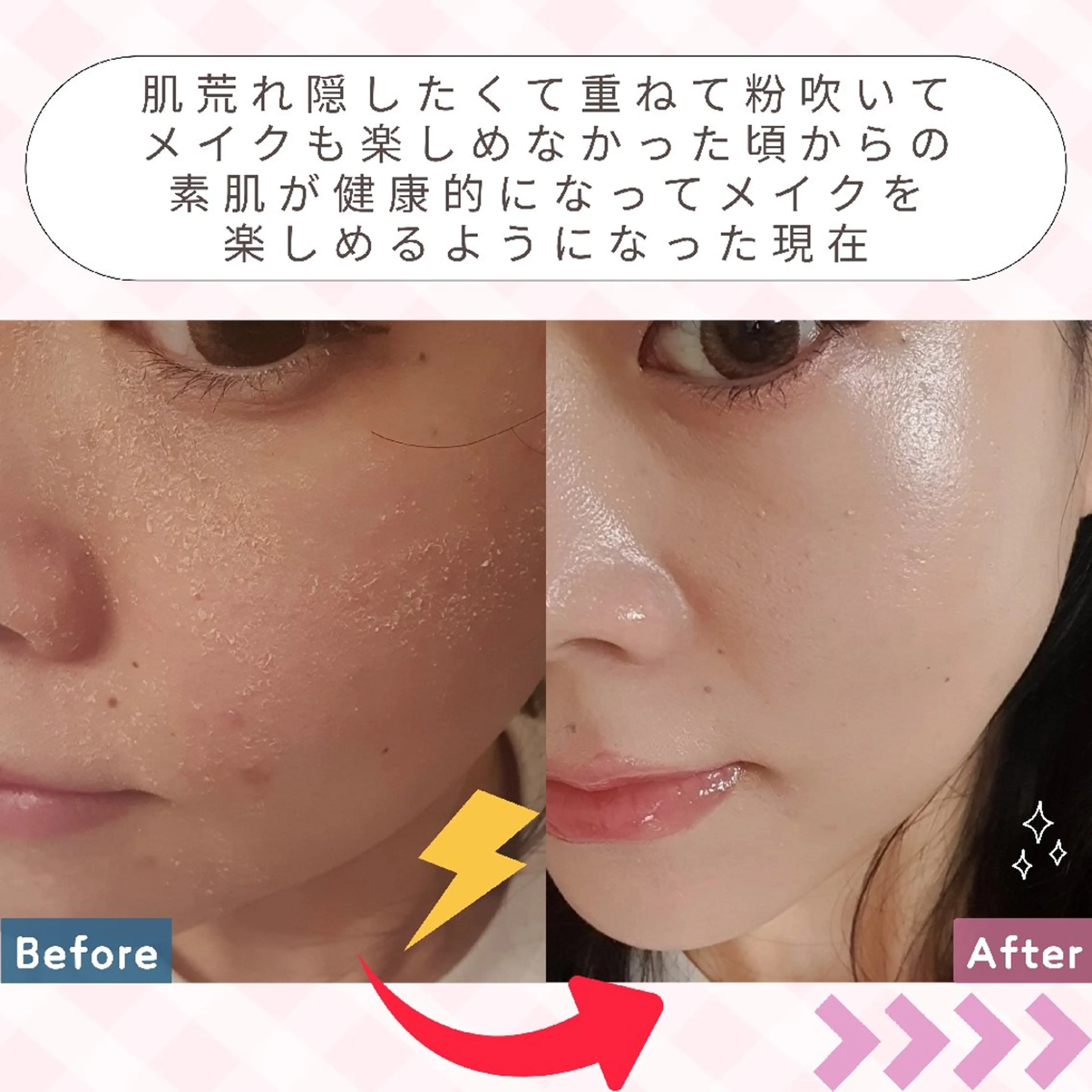 痩身ハーブピーリング 筋膜リリース☆B&Hのエステ・リラクイメージ