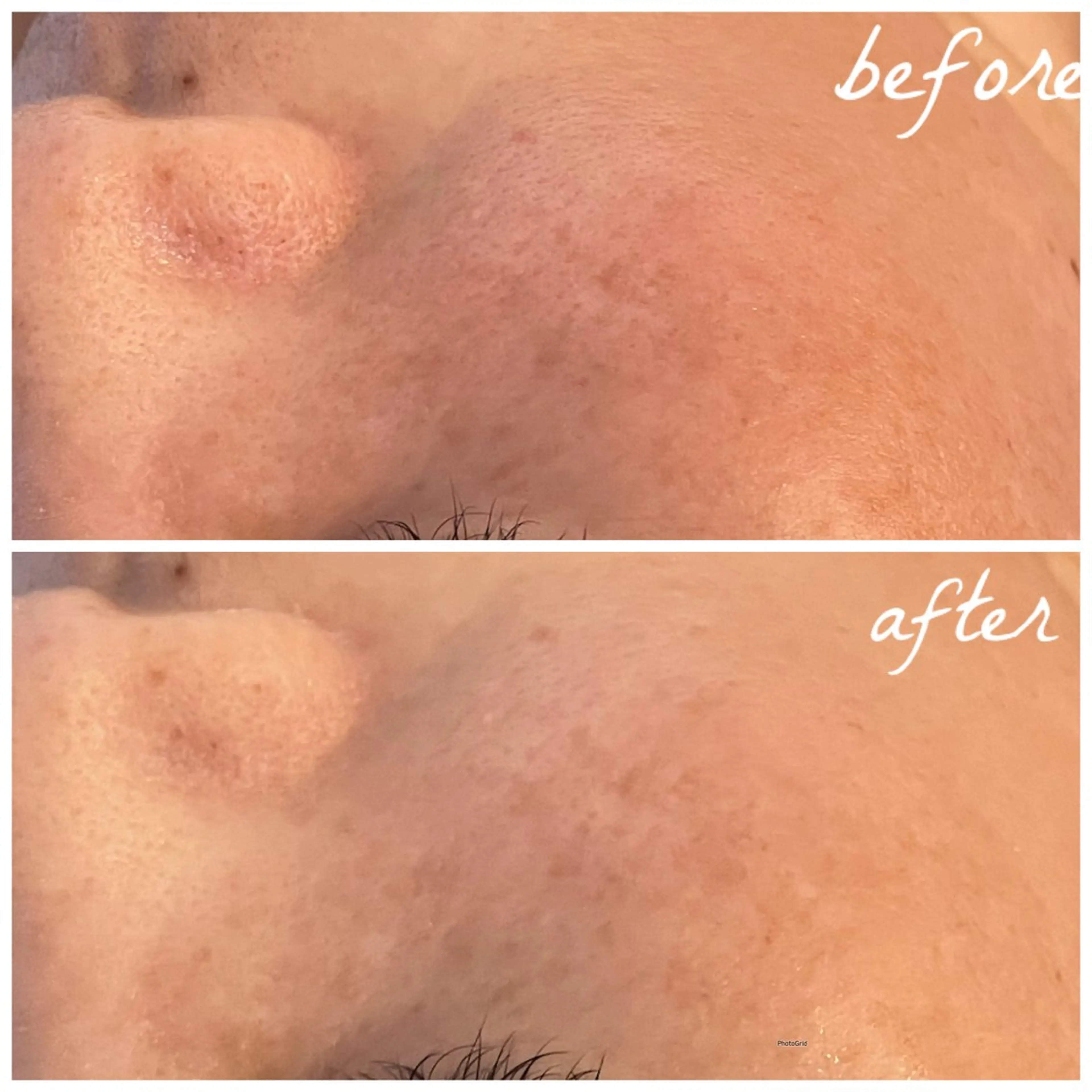 メンズ エステ メナード岐阜市茜部 杉浦のエステ・リラクイメージ