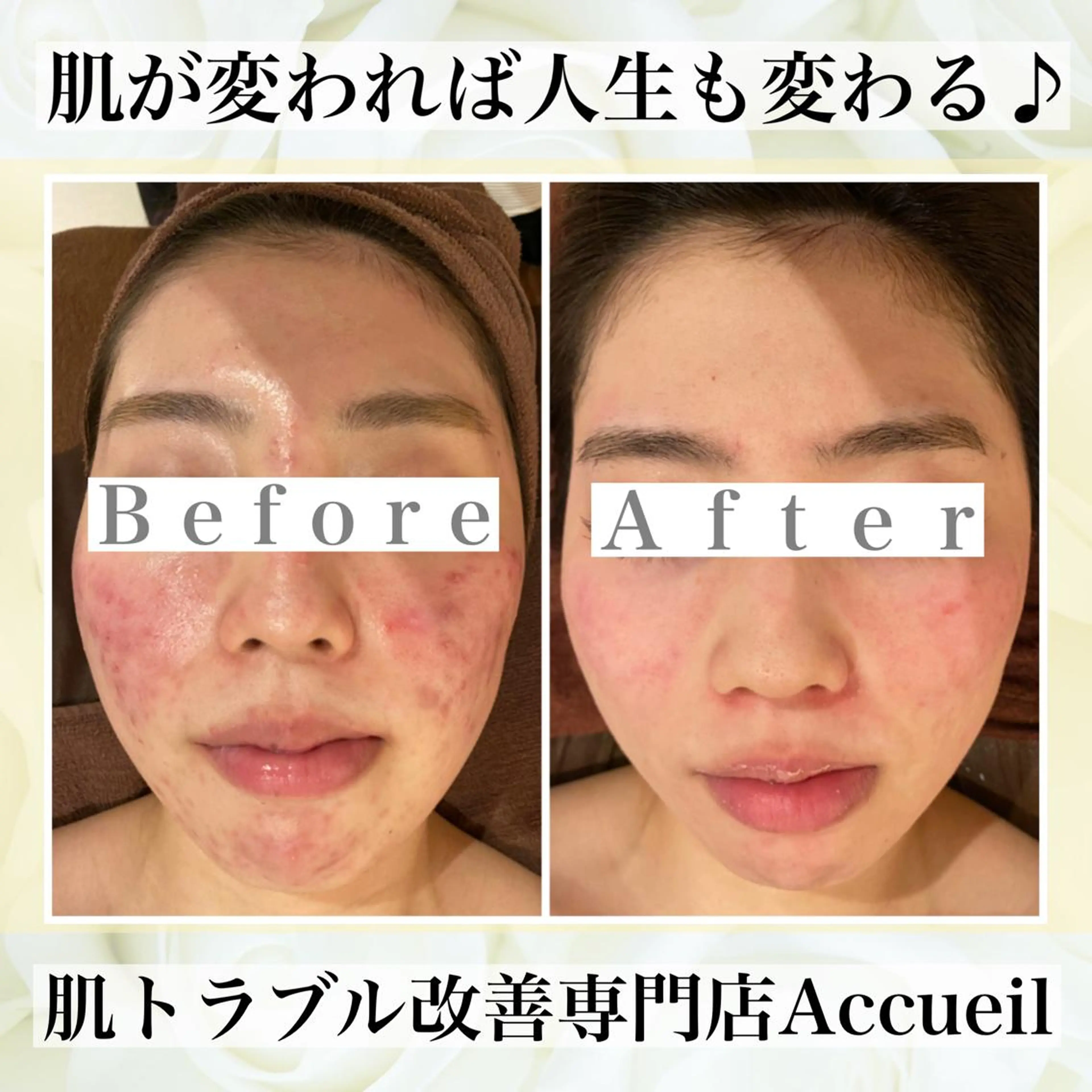 ミディアム カラー パーマ ヘアアレンジ メンズ キッズ ネイル マツエク・マツパ エステ リラク ニキビ・肌質改善専門 ♡人生が変わるサロンのエステ・リラクイメージ