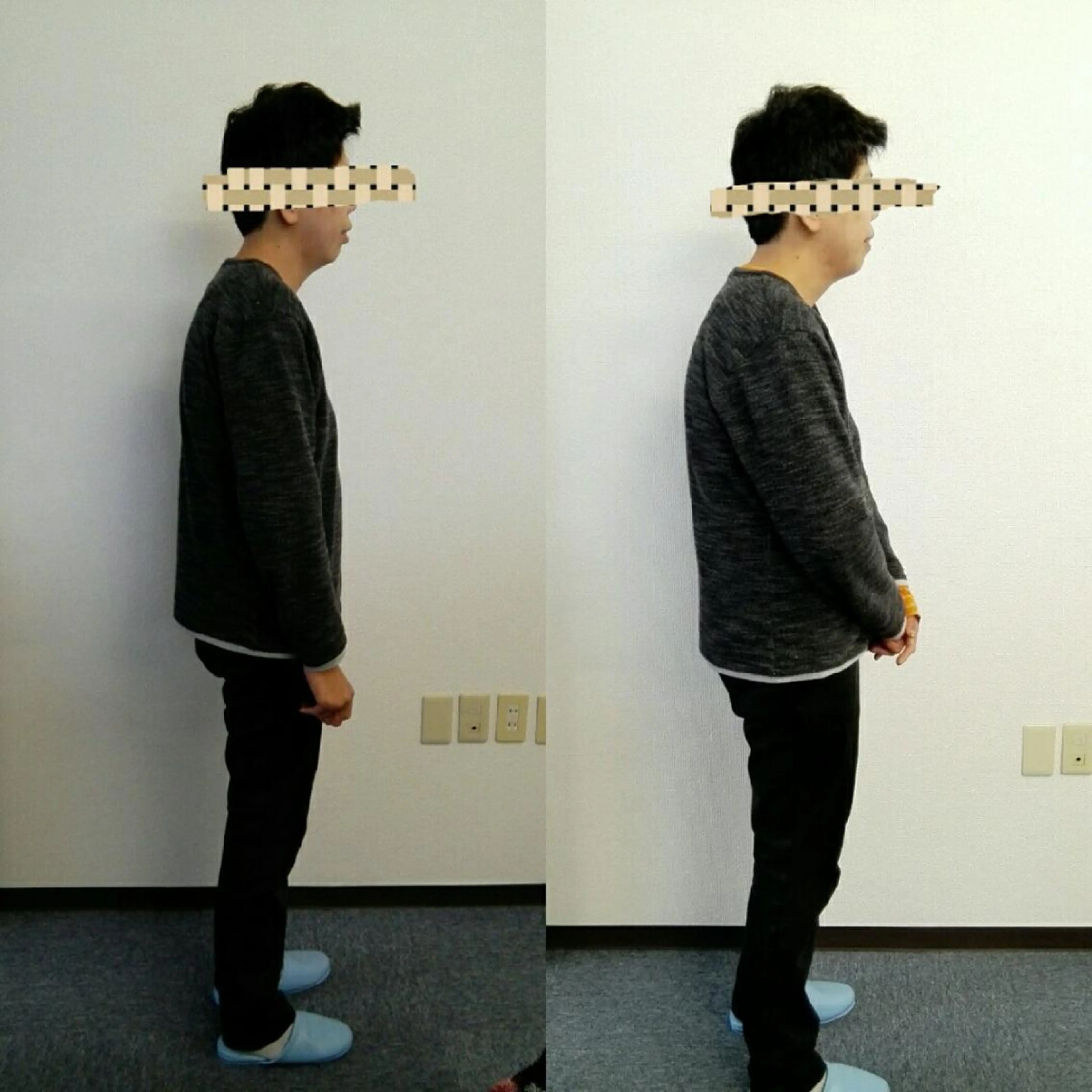 ミニモ限定 ソラール式美容整体 猫背解消の術の写真