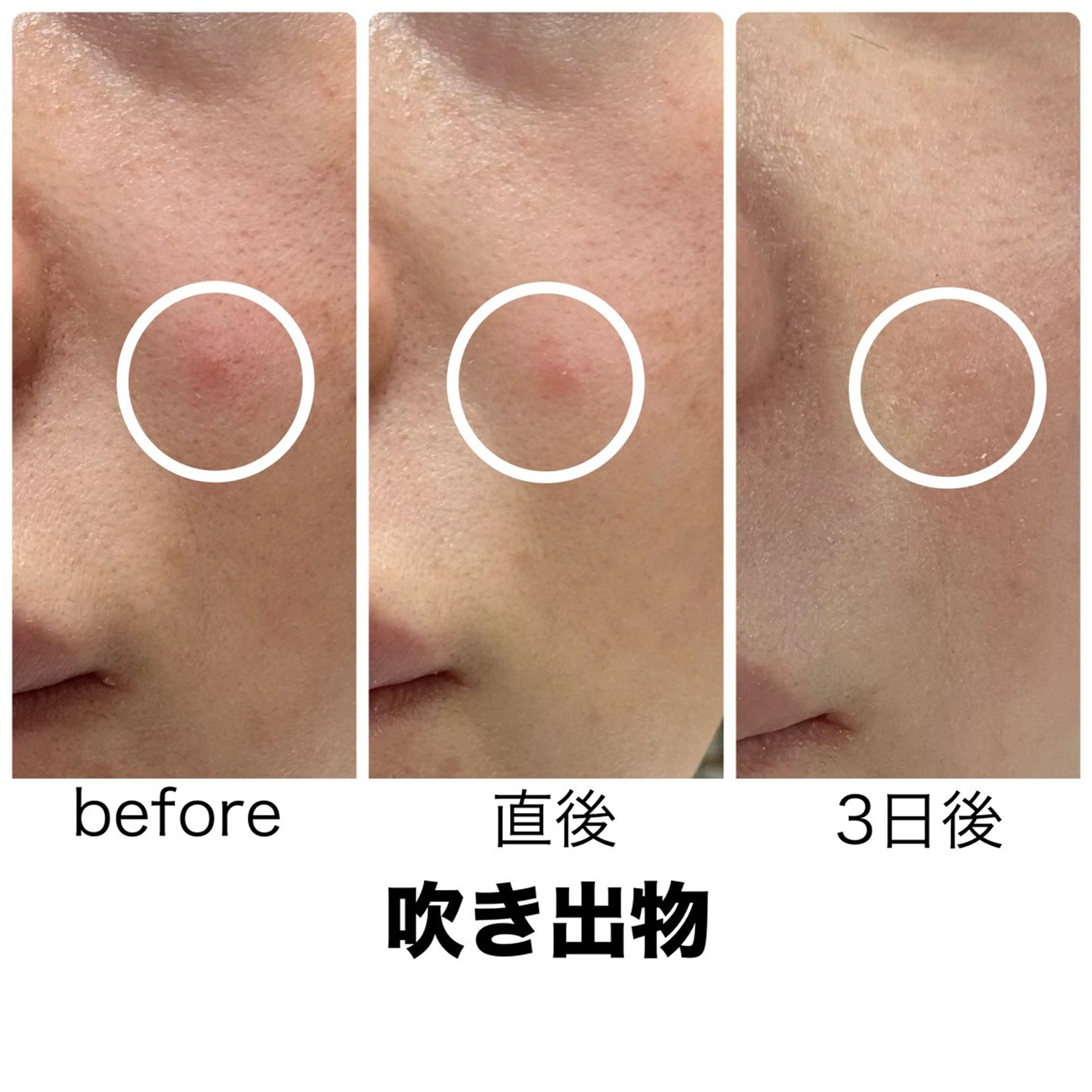 エステ leolo武蔵浦和 肌質改善＆脱毛のエステ・リラクイメージ