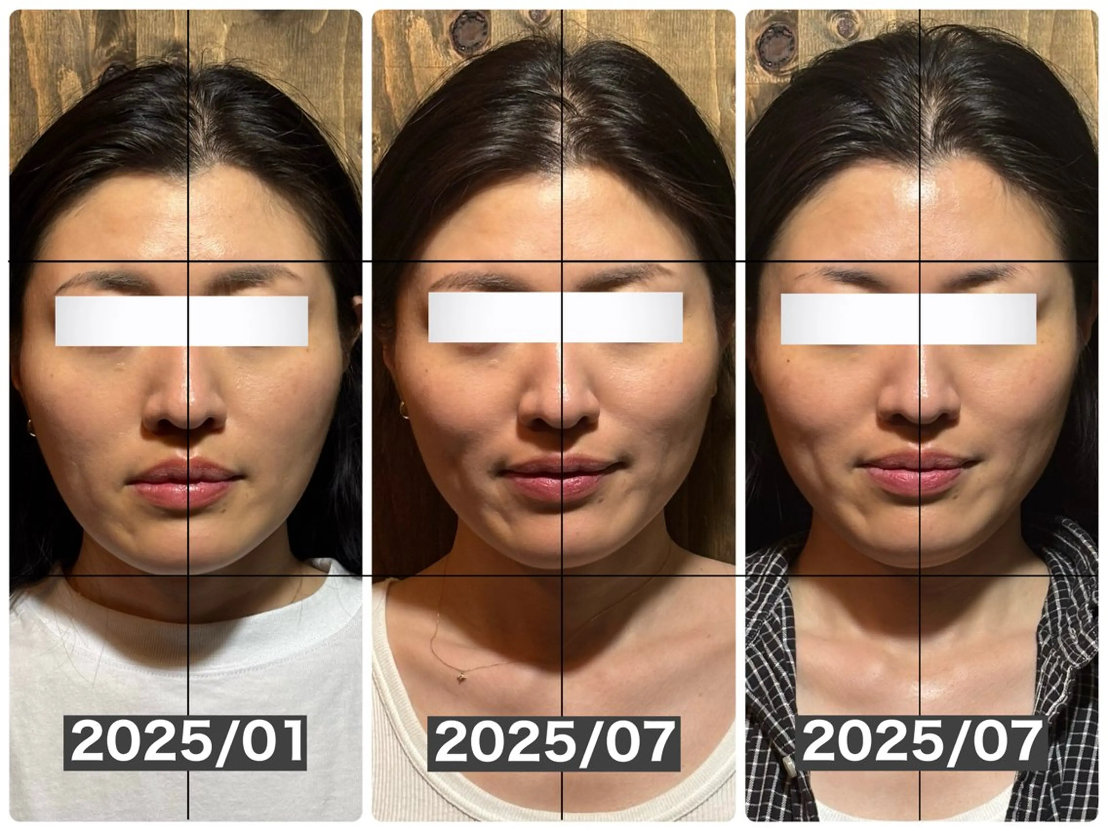 エステ リラク 💎後悔させない小顔 矯正💎イトヤマ🌱のエステ・リラクイメージ