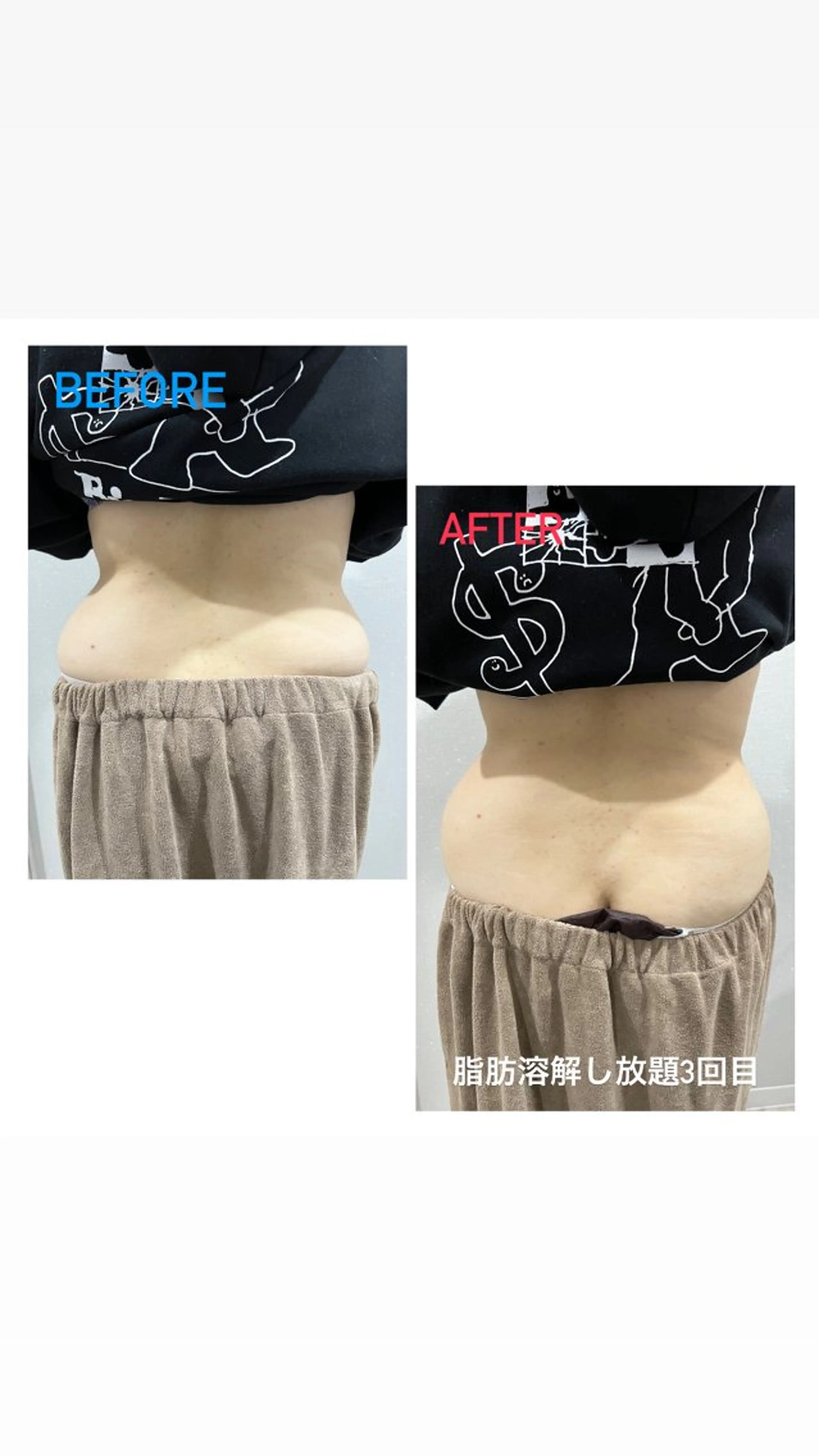 エステ 痩身/毛穴洗浄/脱毛 アルカンジュのエステ・リラクイメージ