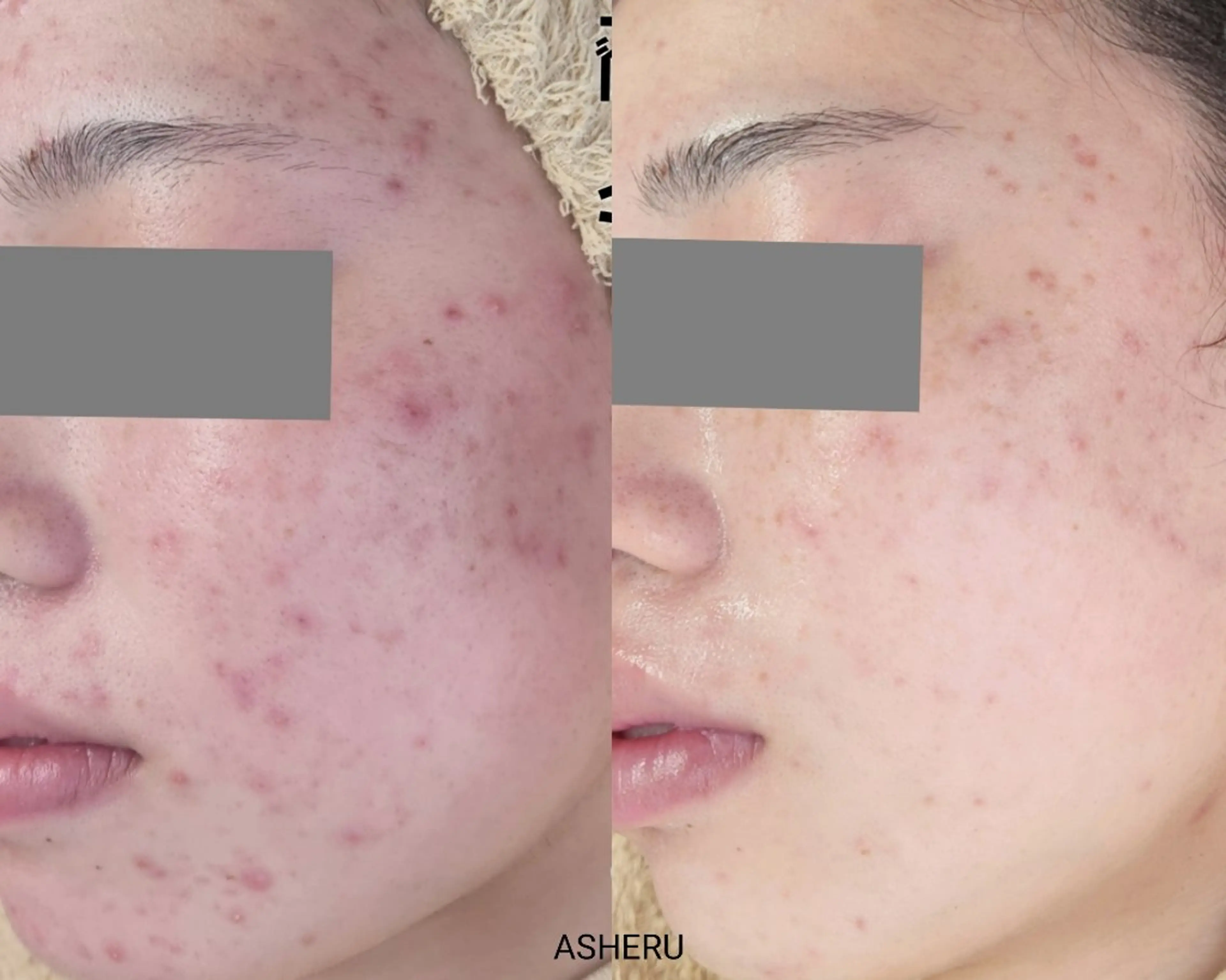 エステ ASHERU* Yuiのエステ・リラクイメージ