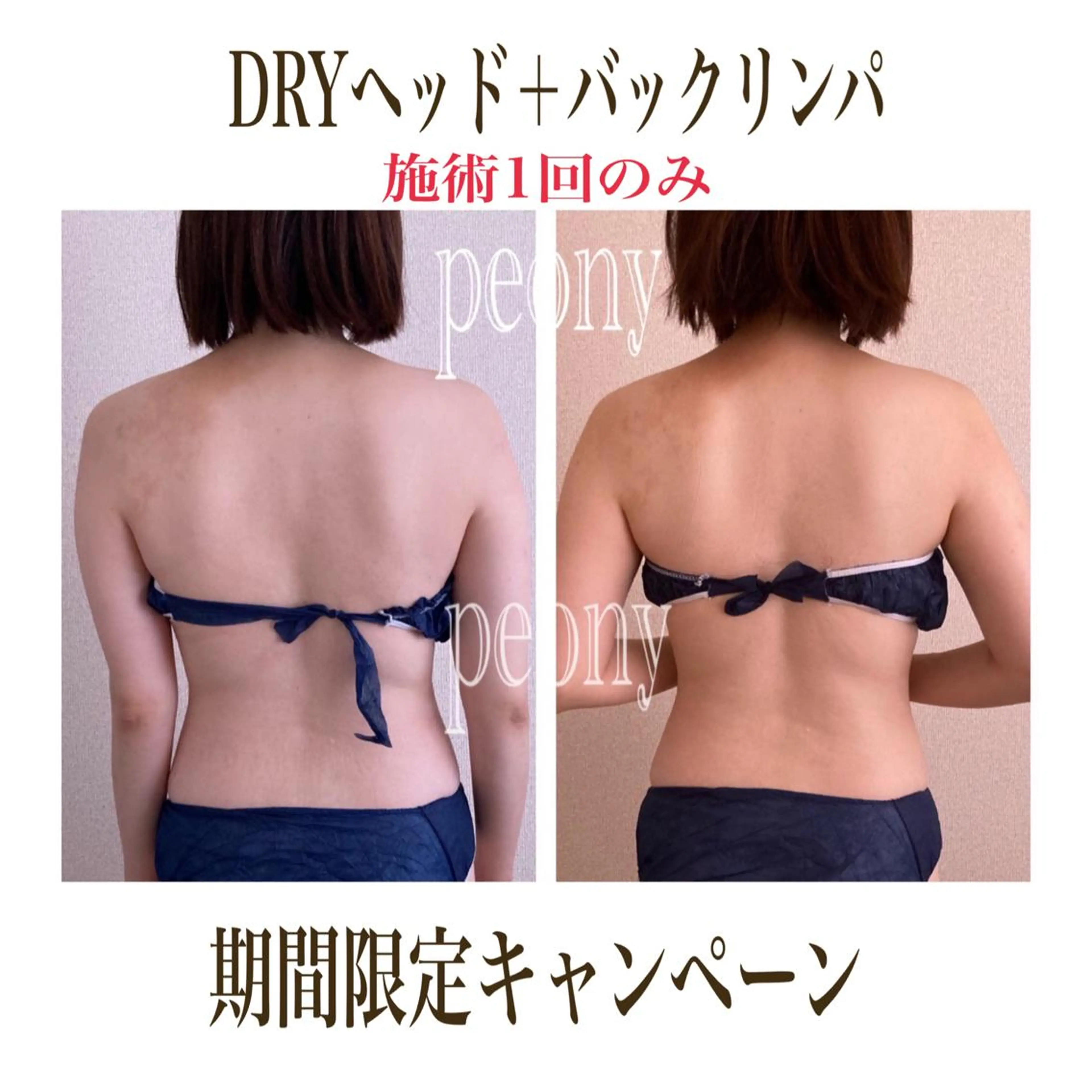 [極上の癒し]🌿超絶睡眠ヘッドスパ＋首肩凝りバックリンパ🌿の写真