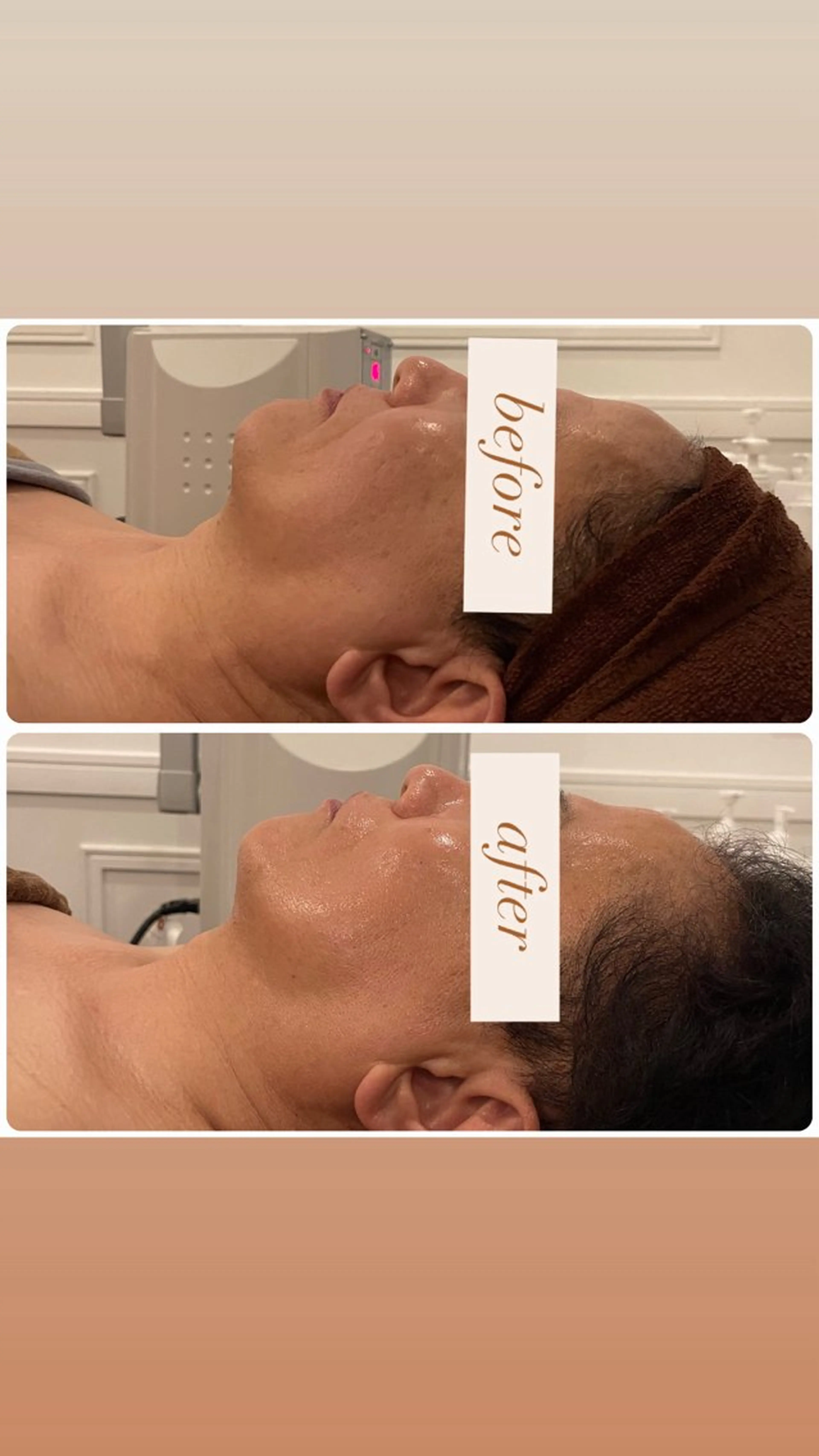 小顔×美肌デザイン✨ 理想へトータルケア◎のエステ・リラクイメージ