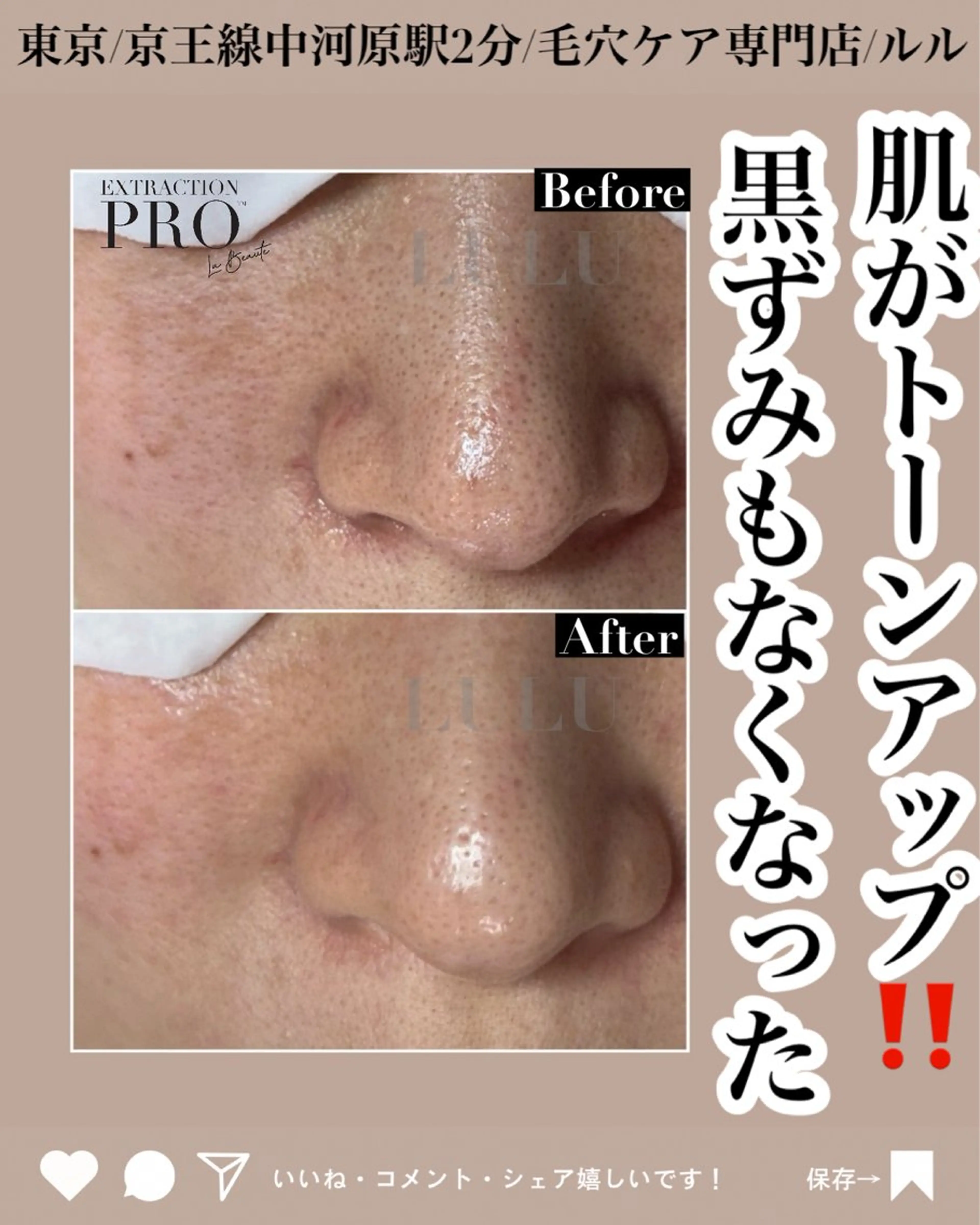 エステ LULU ルルのエステ・リラクイメージ