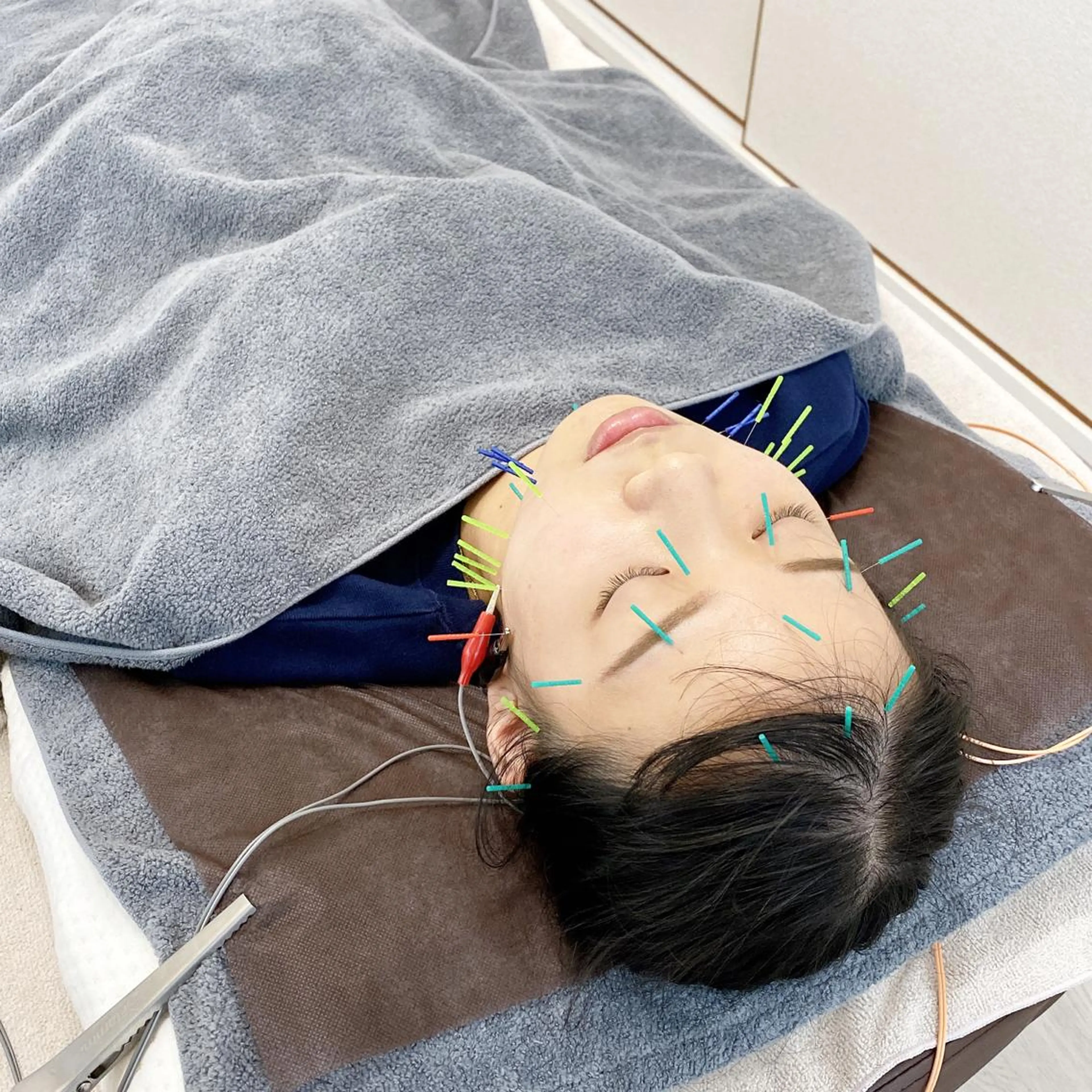 印象の良くなる 美容鍼のエステ・リラクイメージ