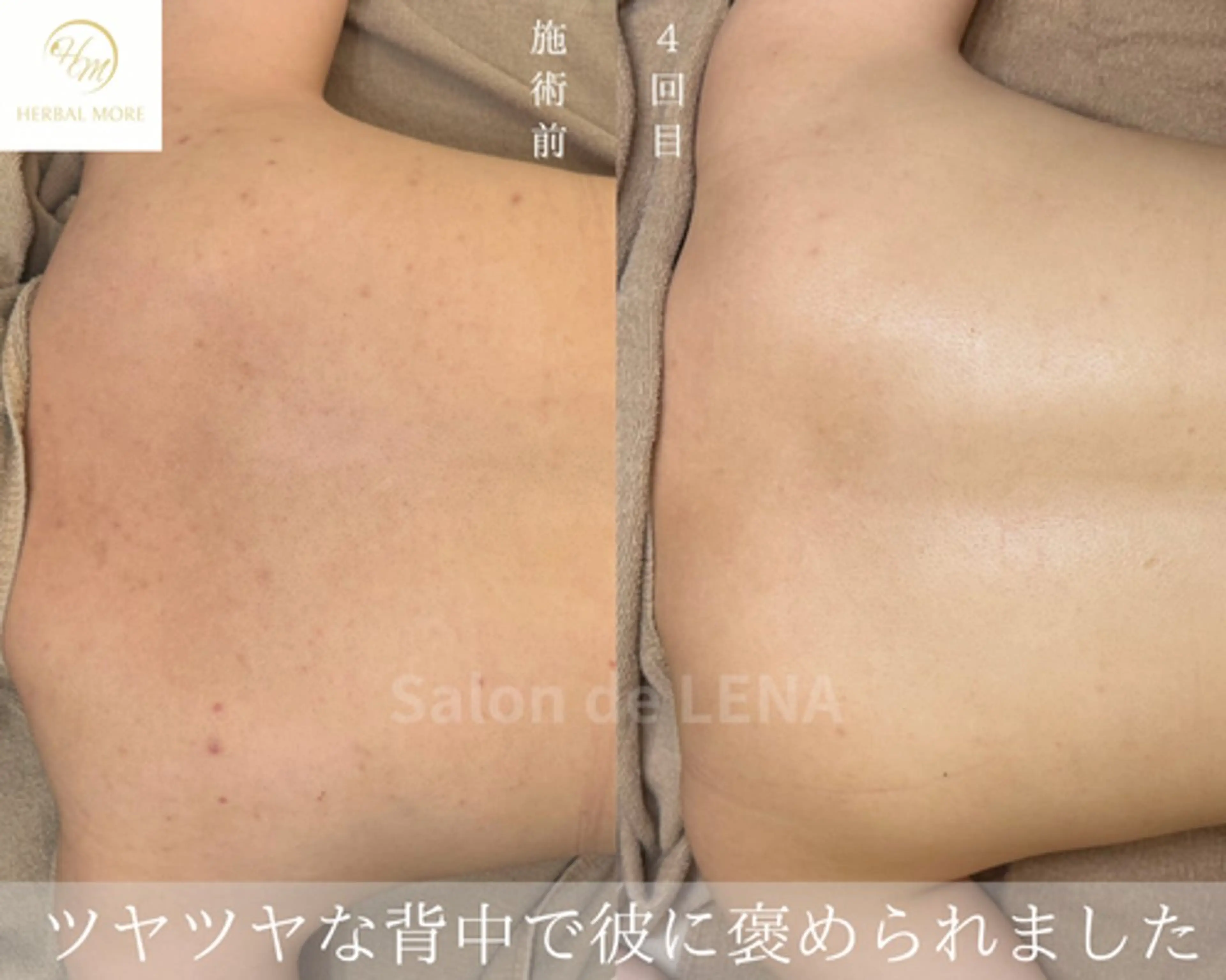 ハーブピーリング・毛穴ケア専門サロンSalon de LENA 栄店所属・ハーブピーリング専門 サロンドレナ　白藤のエステ・リラクイメージ