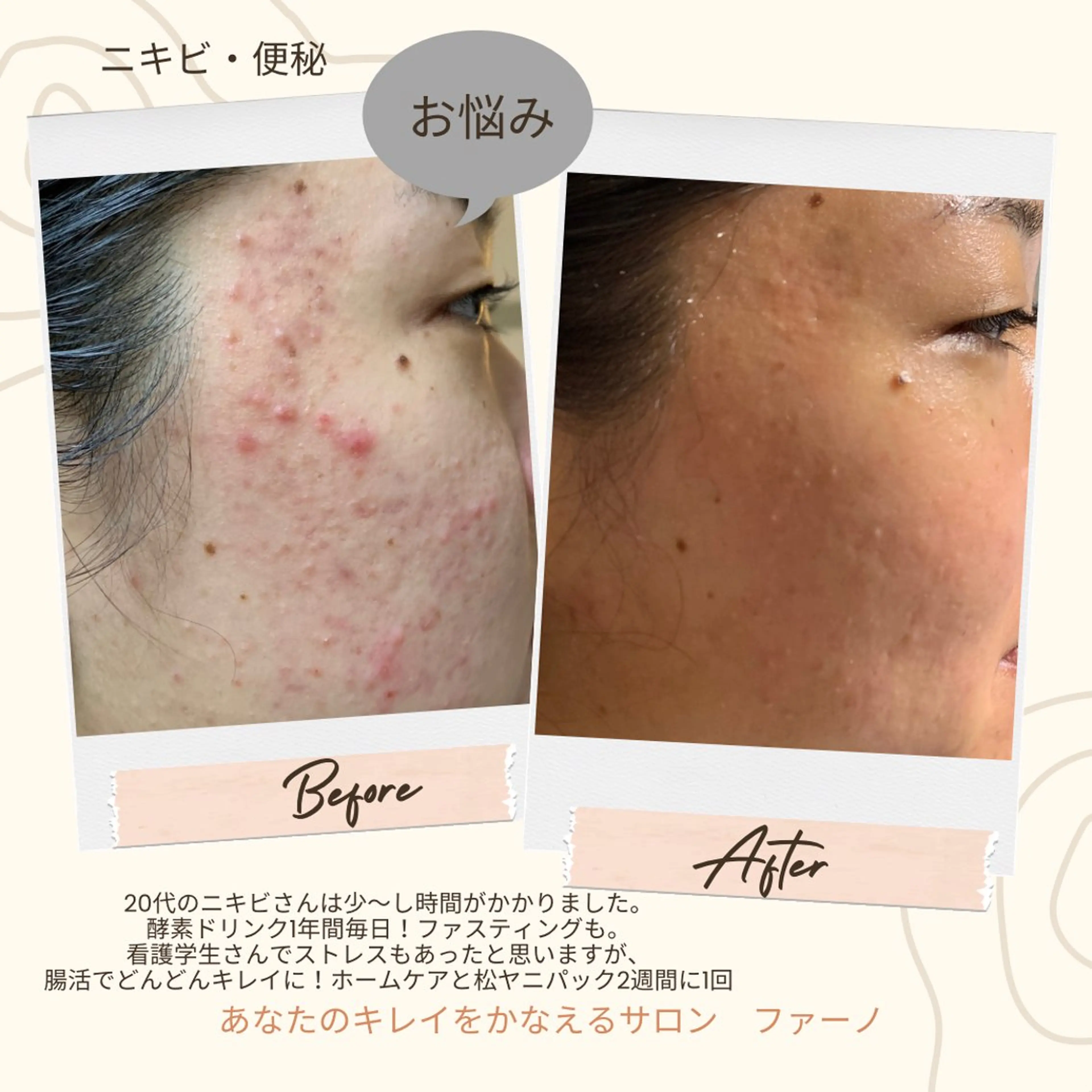 フェイシャルワックス 自然派エステファーノのその他イメージ