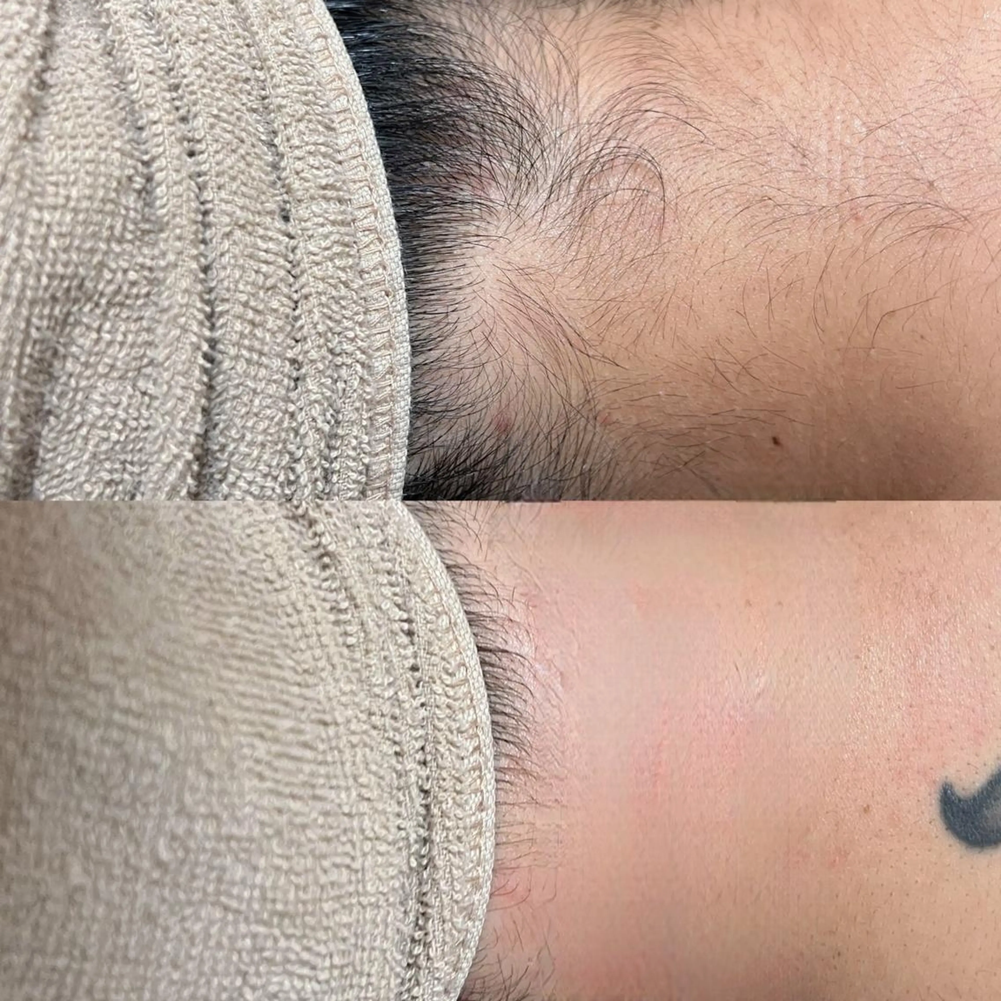 メンズ ヘアアレンジ 脱毛 Epina 千葉店 【エピナ】のエステ・リラクイメージ