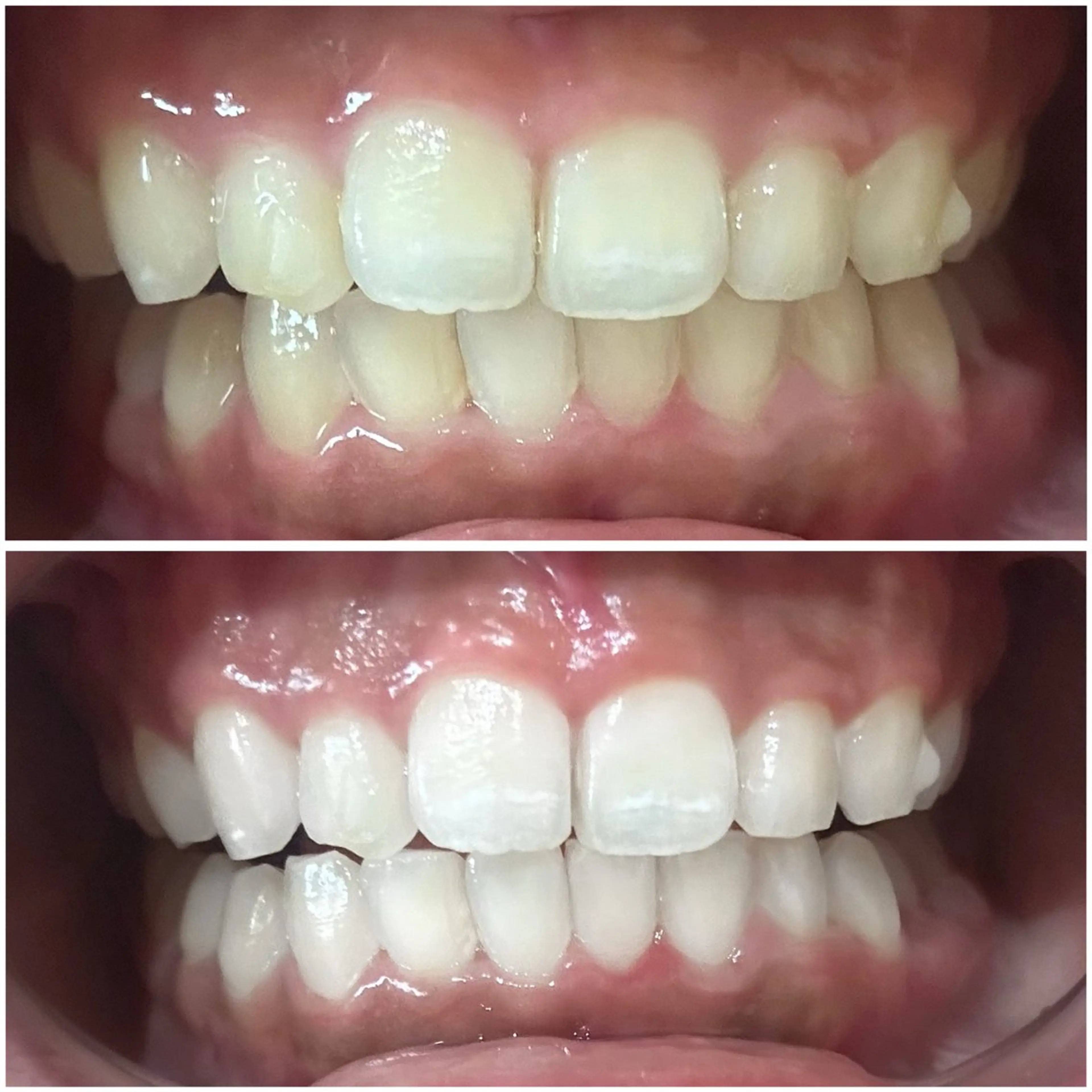 脱毛・ホワイトニング 耳ツボ・美白・毛穴のその他イメージ