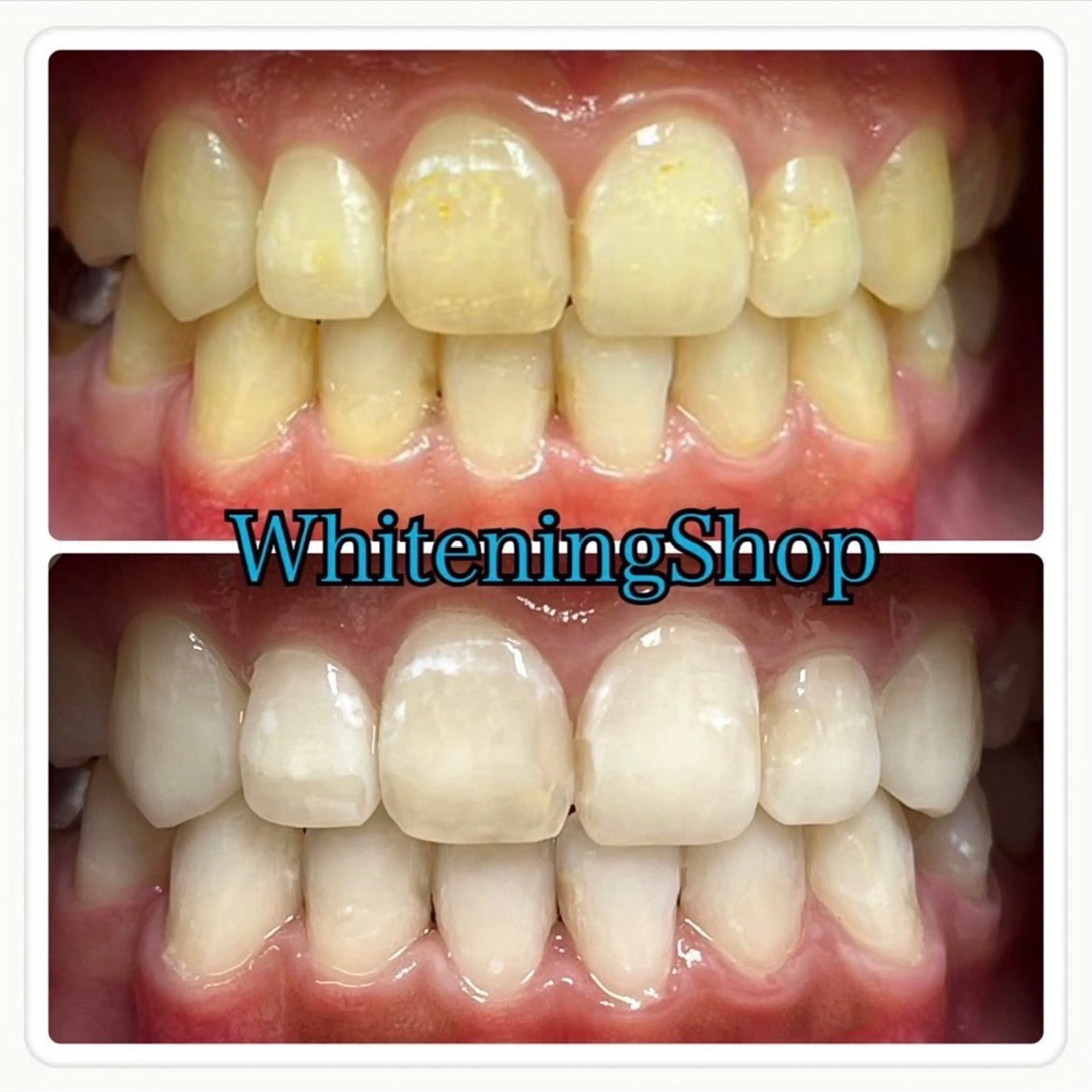 ホワイトニング ショップ吉祥寺店のエステ・リラクイメージ