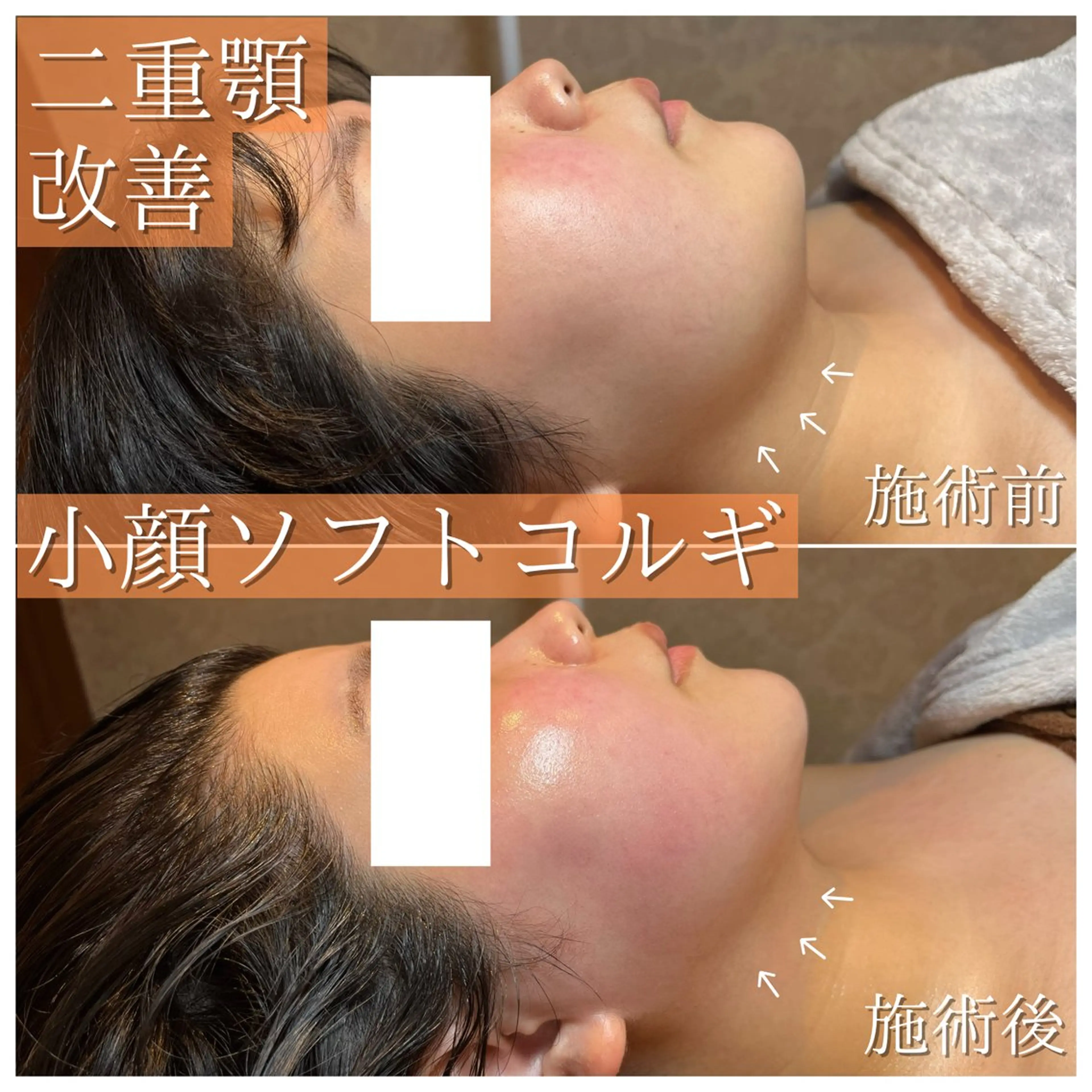 La Dusa 韓国肌管理/小波のエステ・リラクイメージ