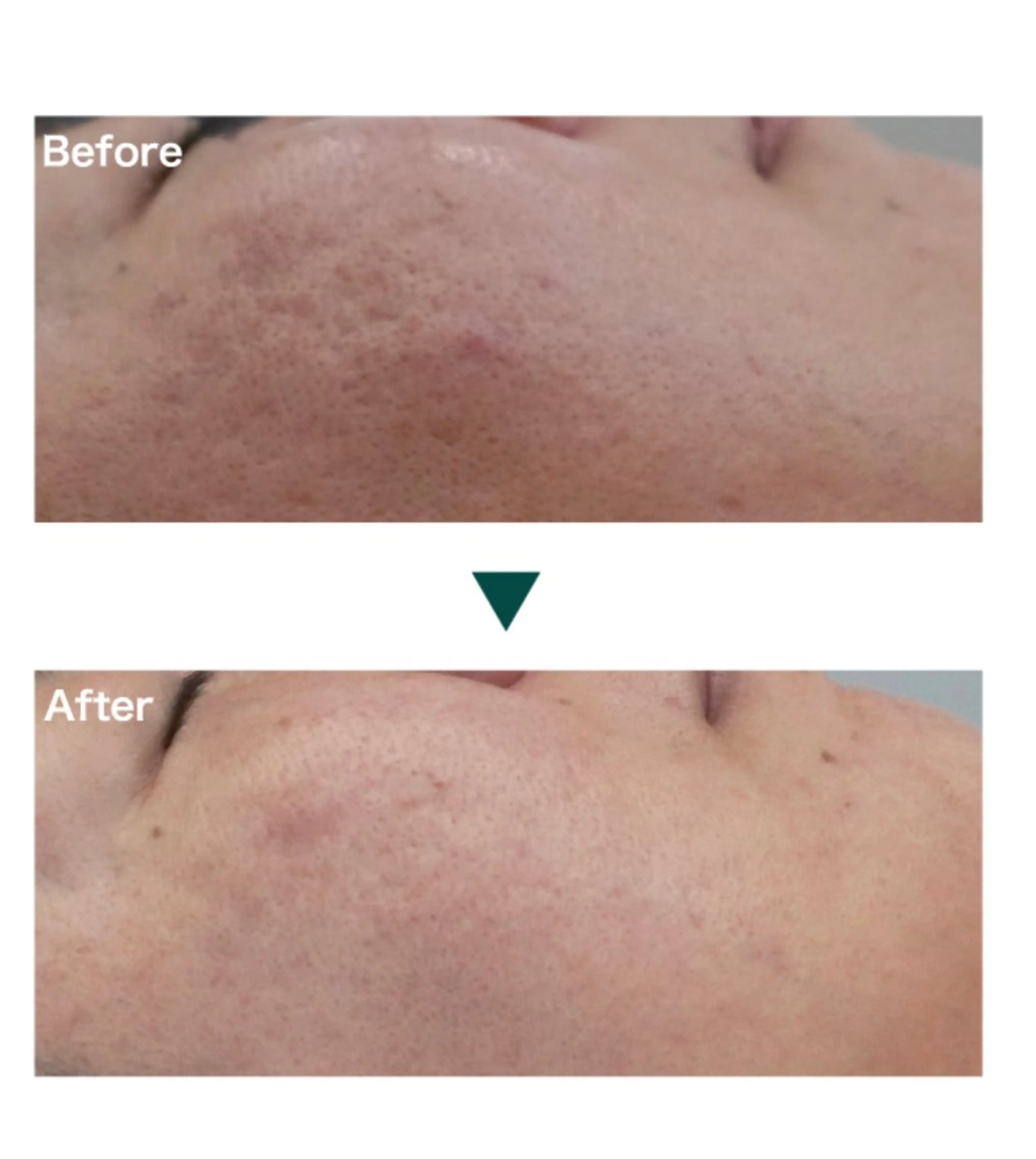 プライベートサロン belleのエステ・リラクイメージ