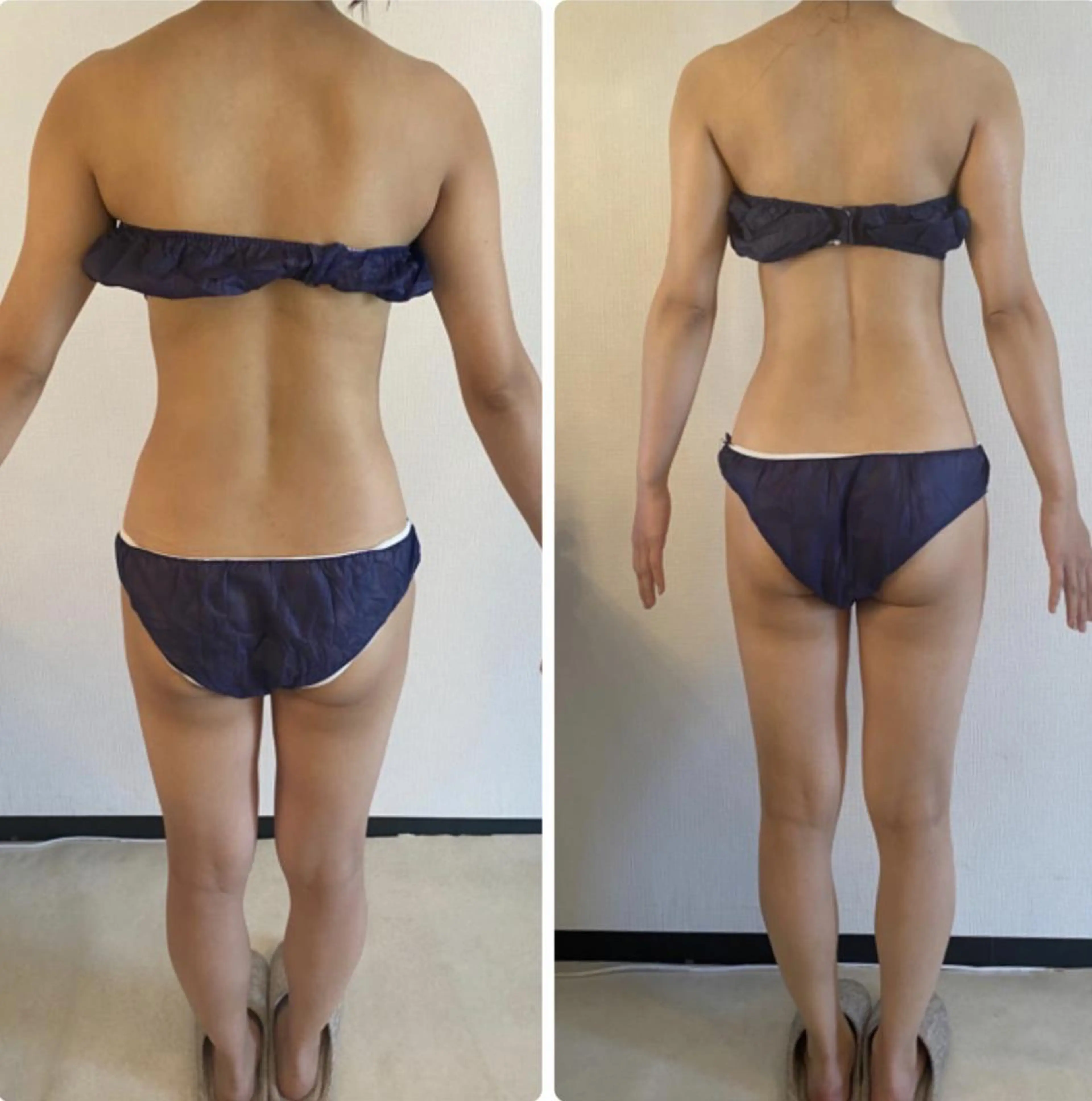 ボディ痩身エステ全身コース(美容整体付き)の写真