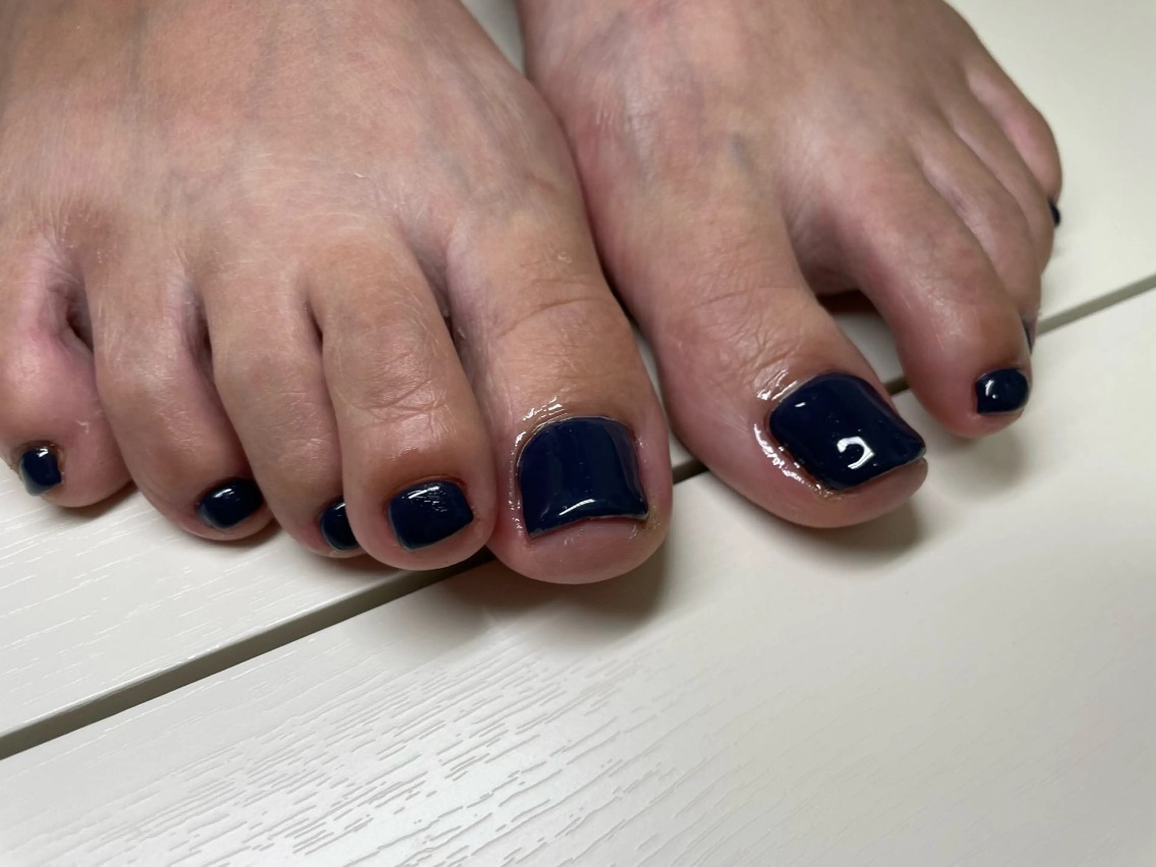 ネイル フットネイル MoonLight SHINOのネイルデザイン