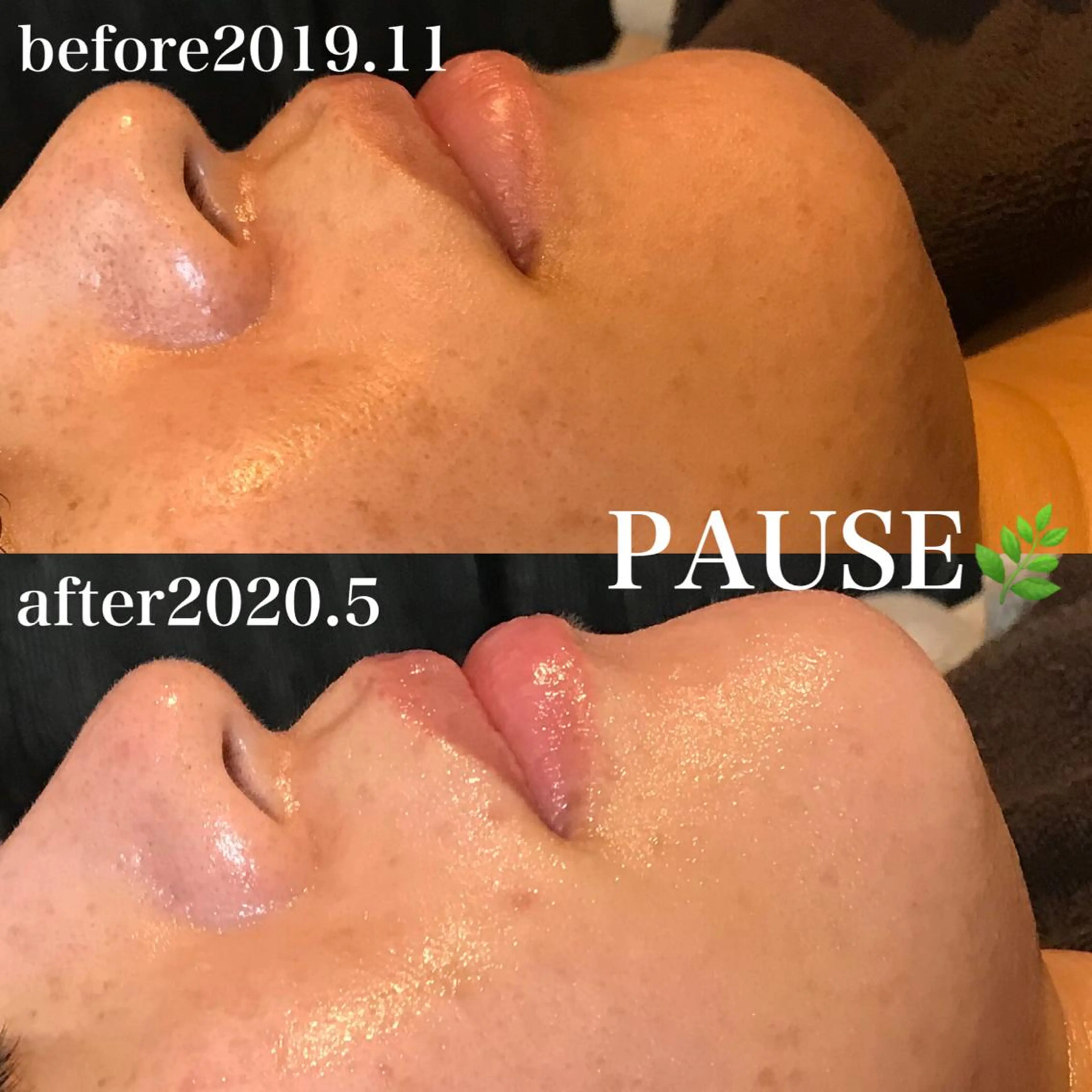 エステ 浜野 恵美のエステ・リラクイメージ