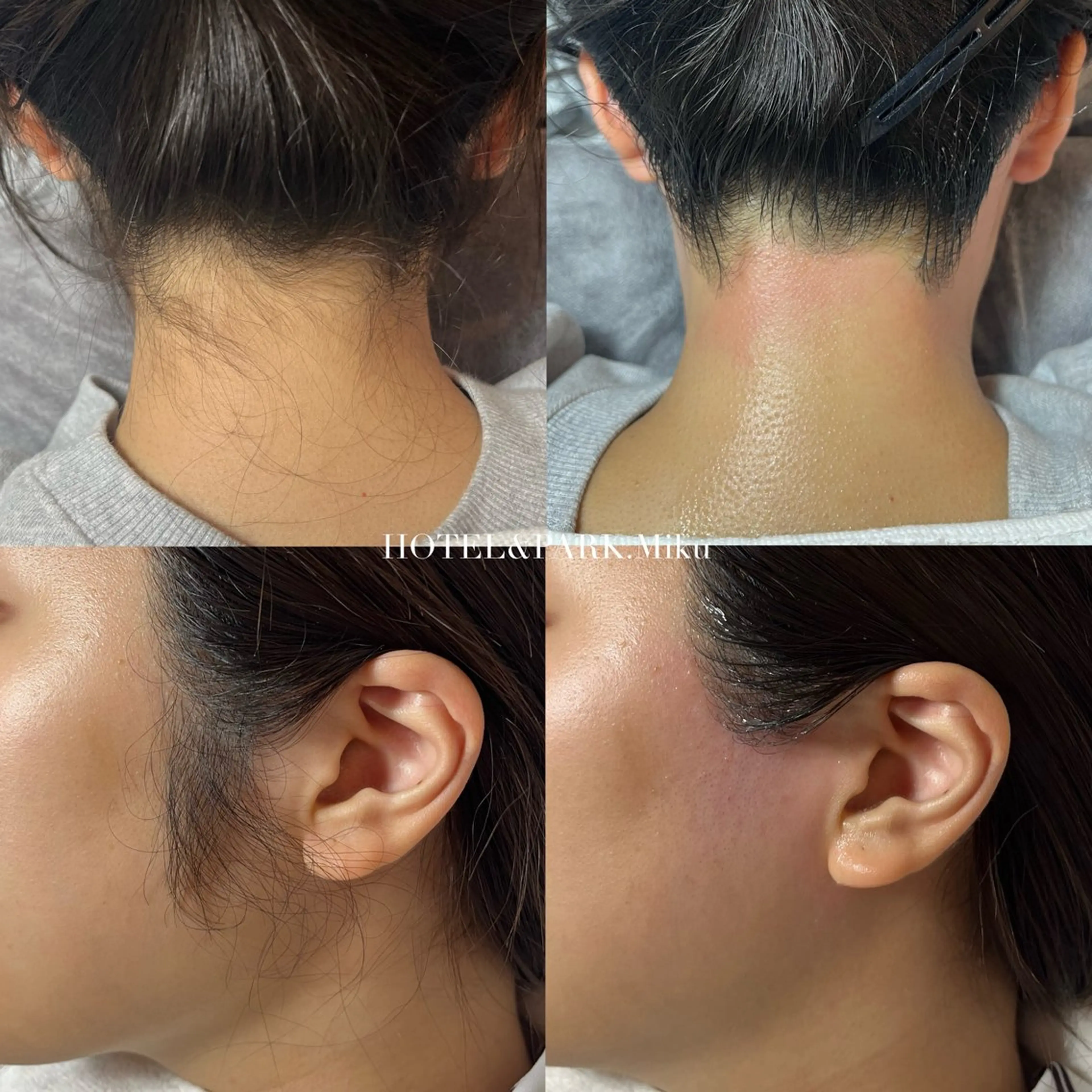 HOTEL&PARK Mikuワックス脱毛のエステ・リラクイメージ