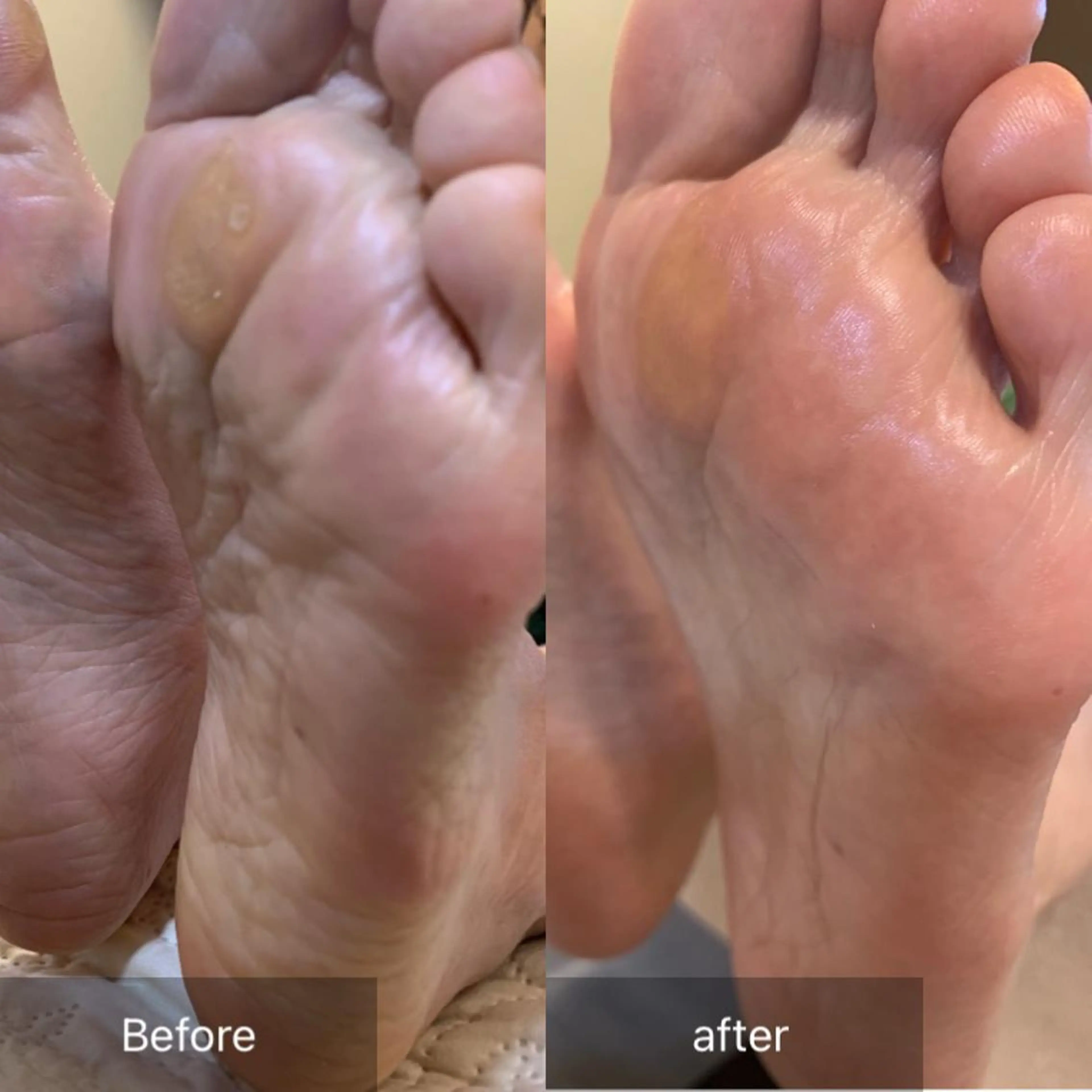 ネイル フットネイル その他(ネイル) 木村 千晴のネイルデザイン