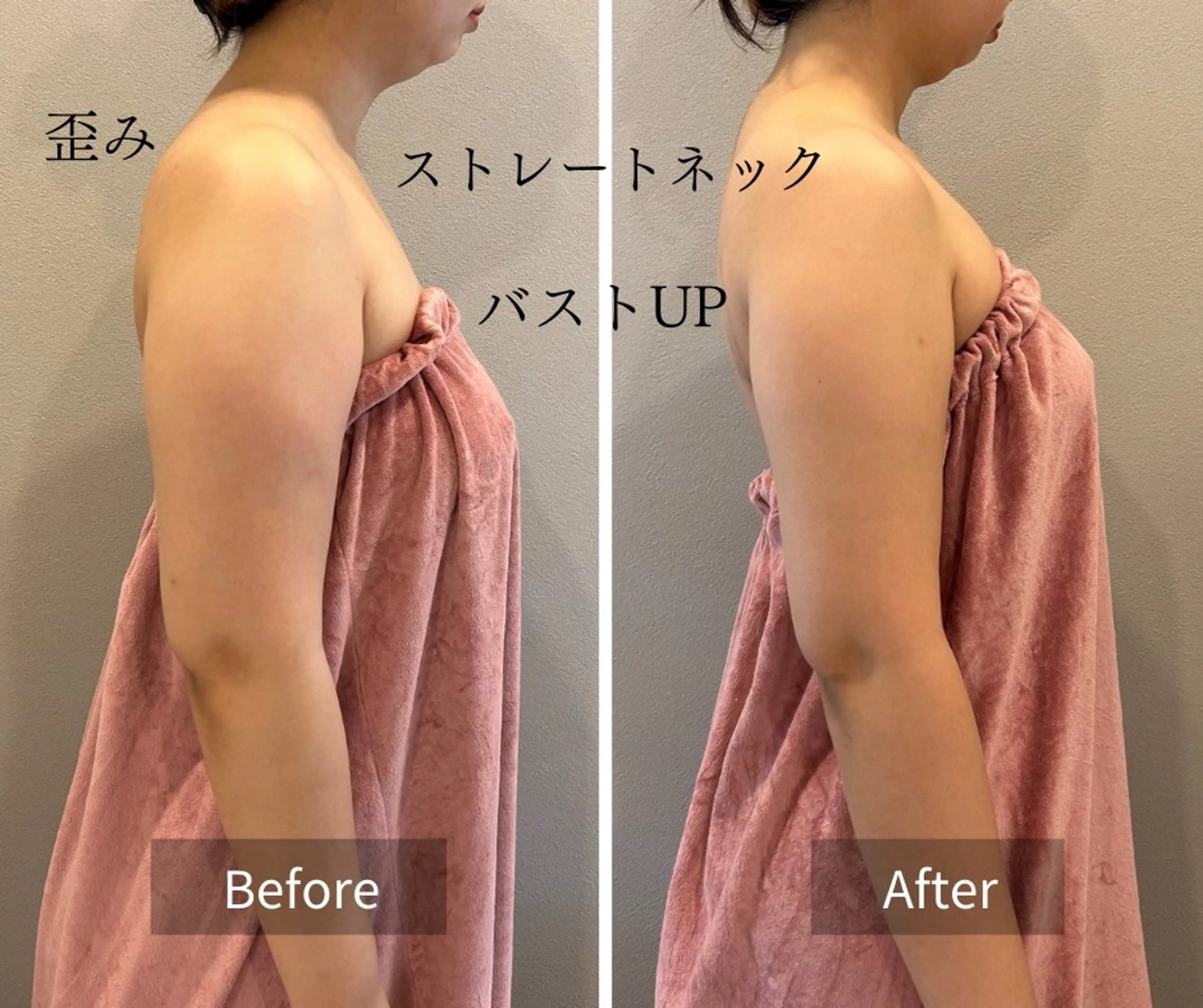 【産後ケア専用】下垂・ハリ低下に◎根本から整える本格バスト施術の写真