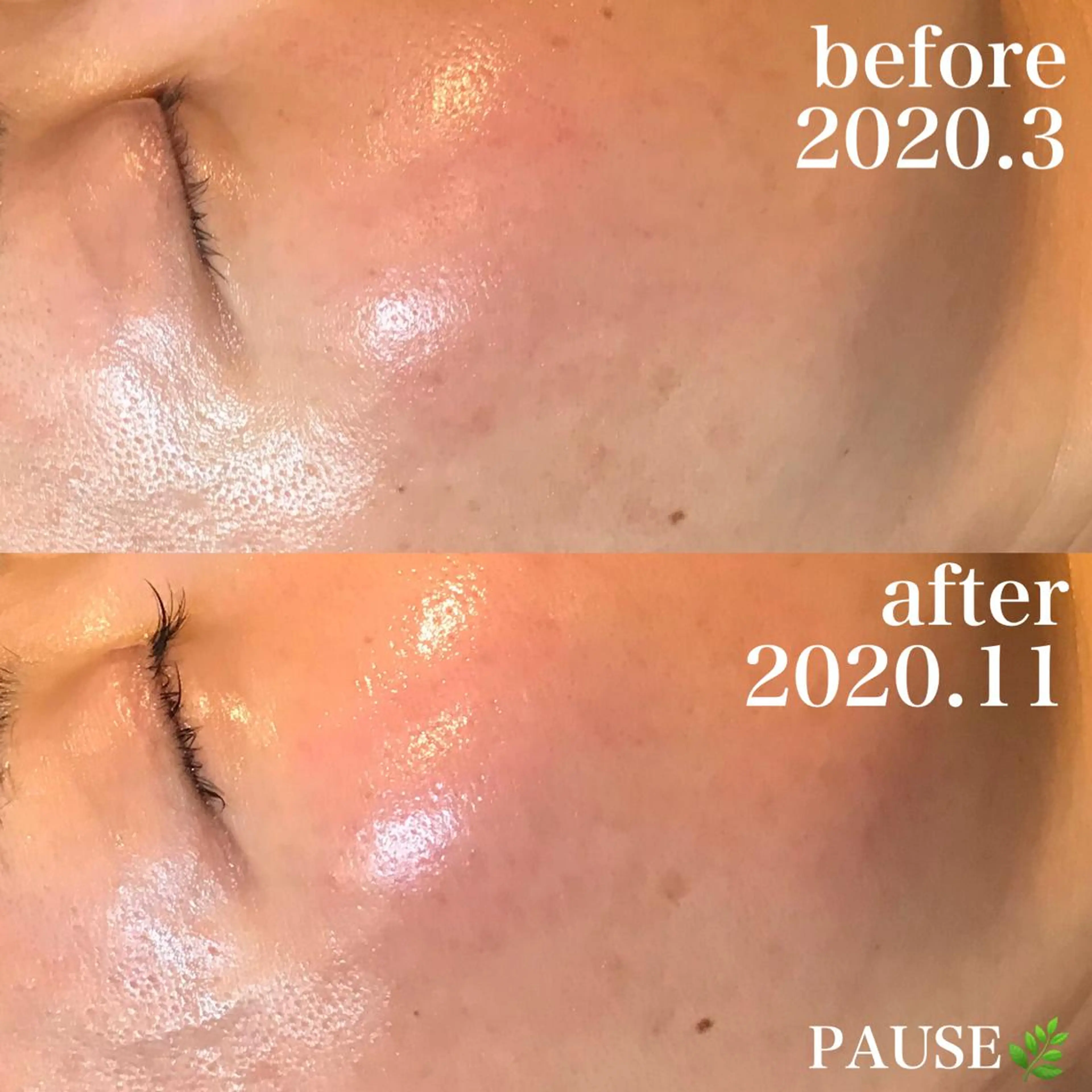 エステ 浜野 恵美のエステ・リラクイメージ