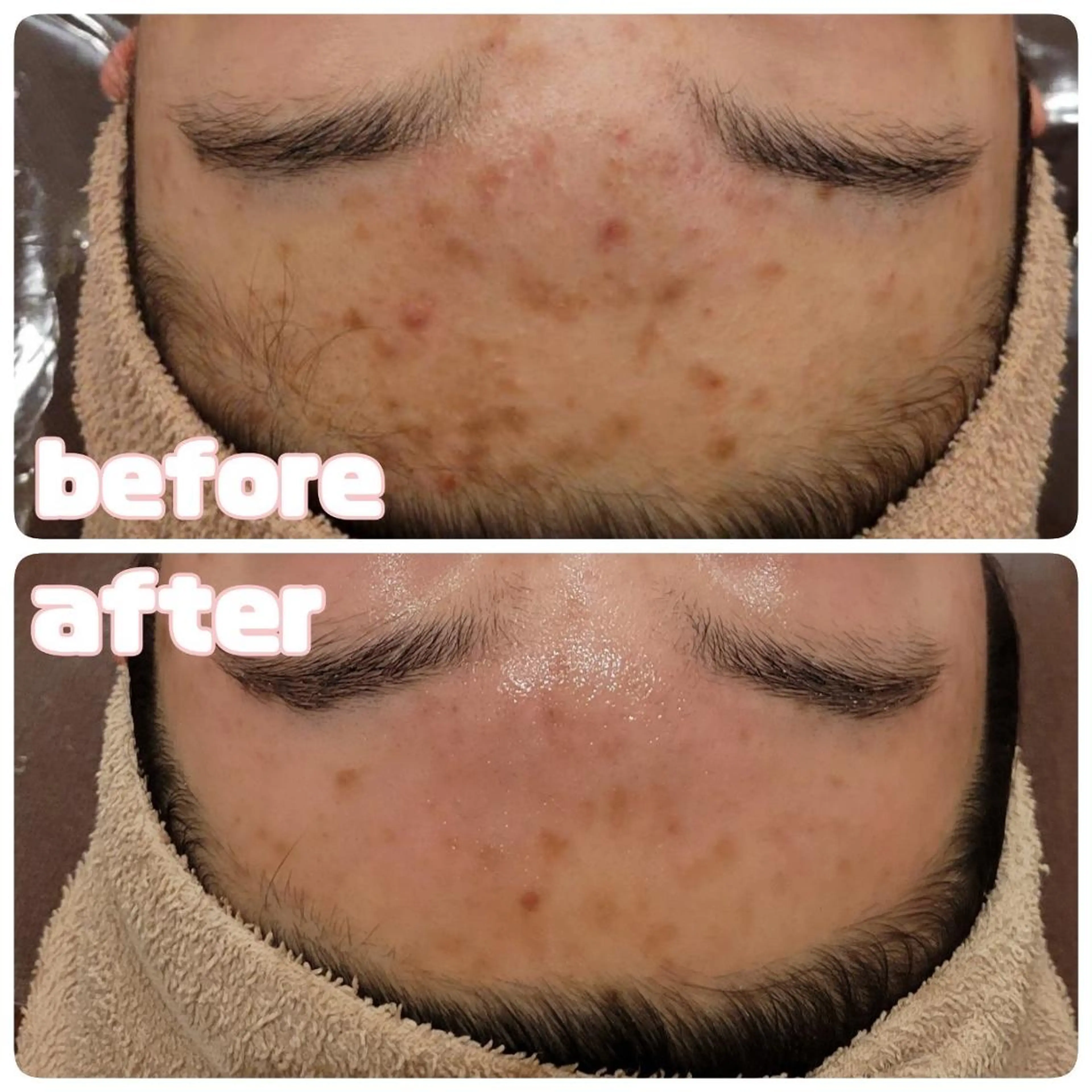 🤍Linola🤍 レイビス 須藤のエステ・リラクイメージ