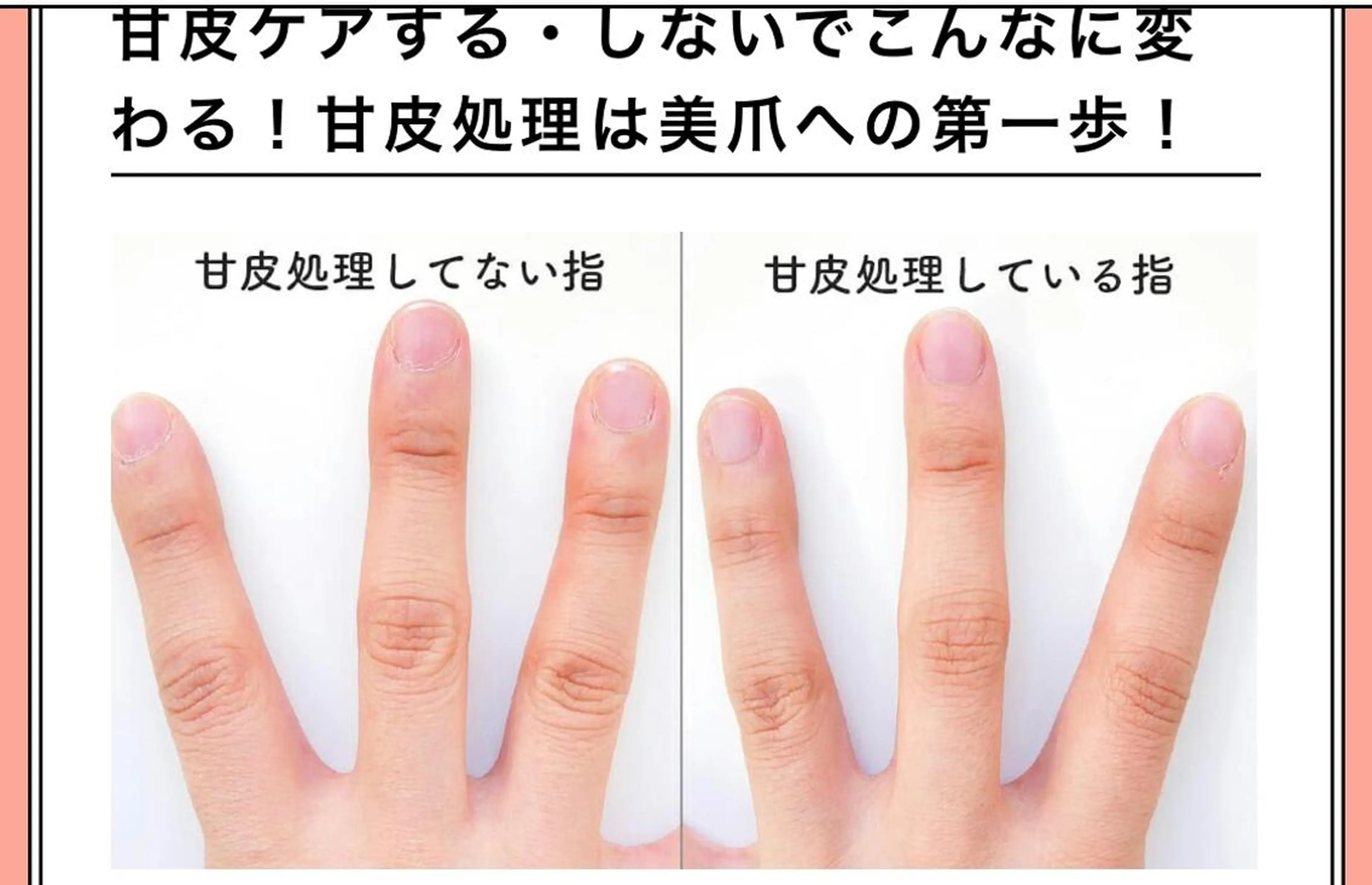 ネイル 痩身/脱毛/ネイル HARUKAのエステ・リラクイメージ