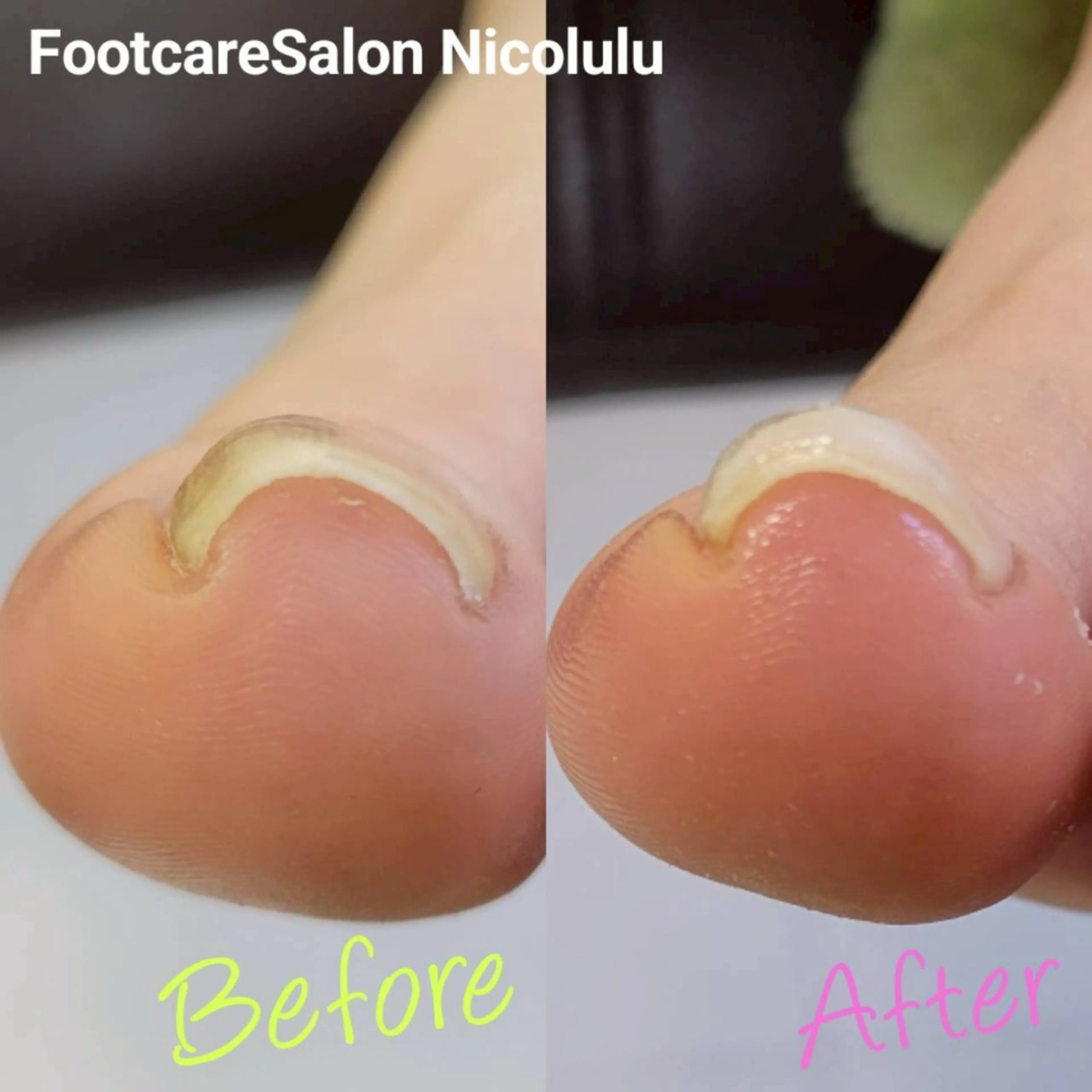 リラク 足トラブル専門 ニコルル金沢のエステ・リラクイメージ