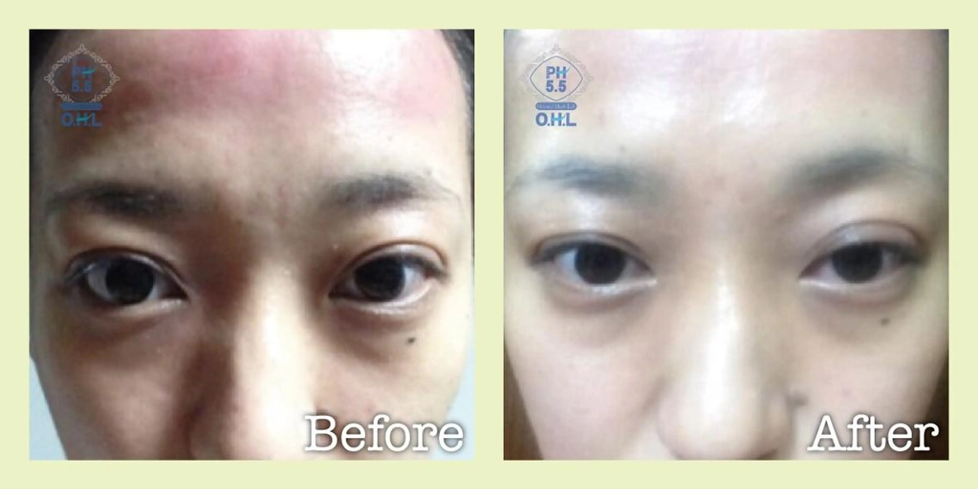 CLEAD 赤坂のエステ・リラクイメージ