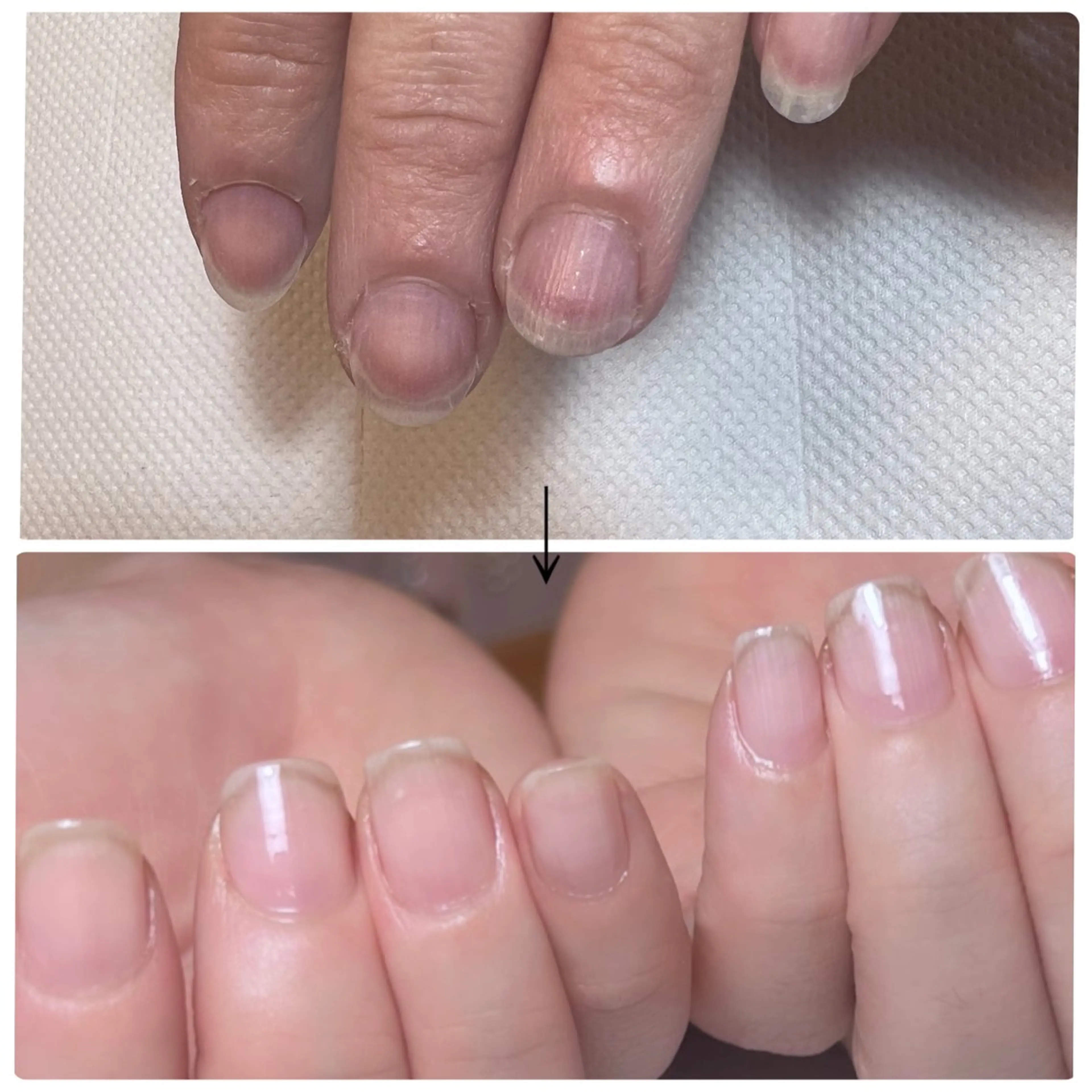 ネイル ハンドネイル ハンドケア 【爪の育成専門】深爪・むしり癖・丸い爪・ガサガサなど　　Rio nail所属・Rio nail まなみのネイルデザイン