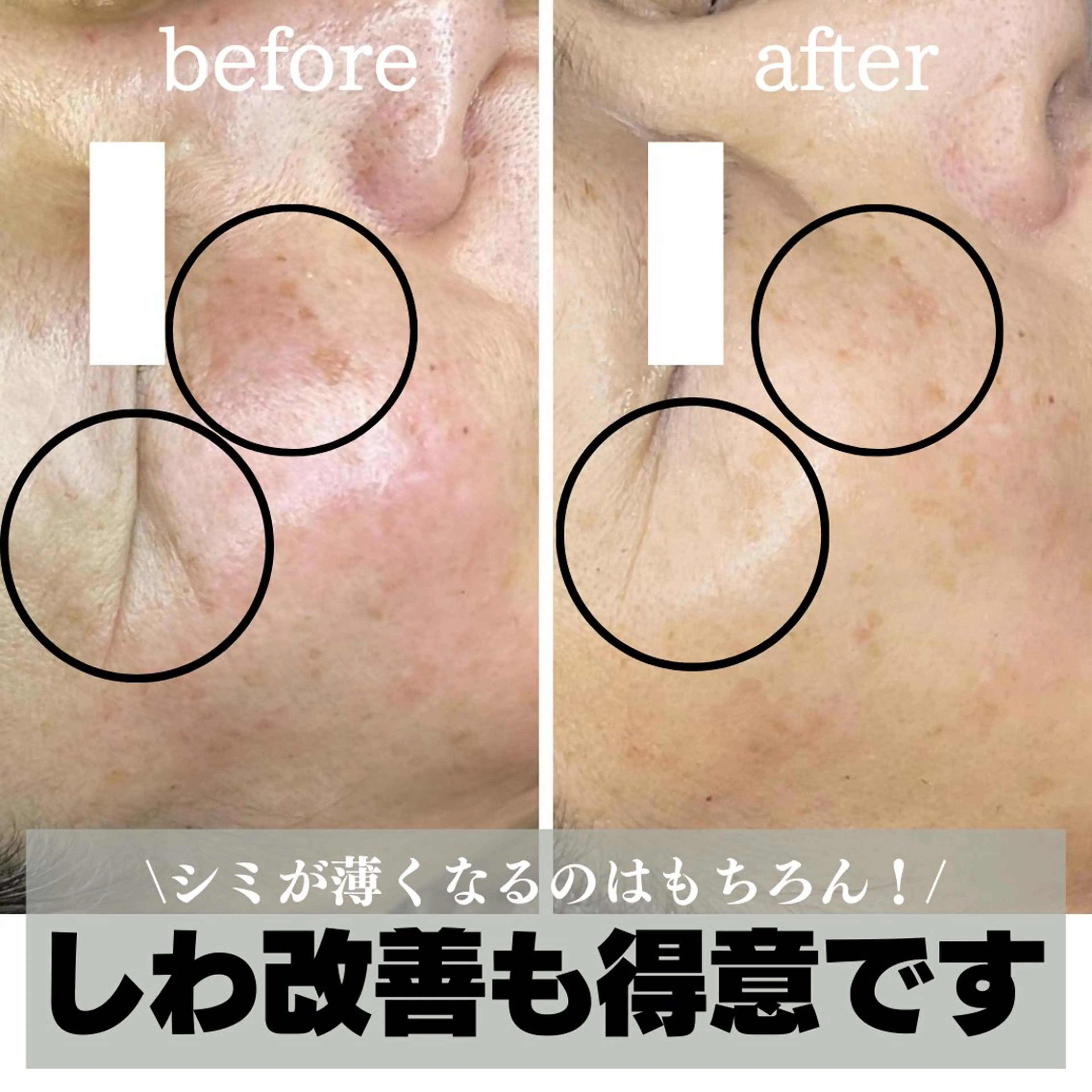 エステ 最新シミケアLily de pearlのエステ・リラクイメージ