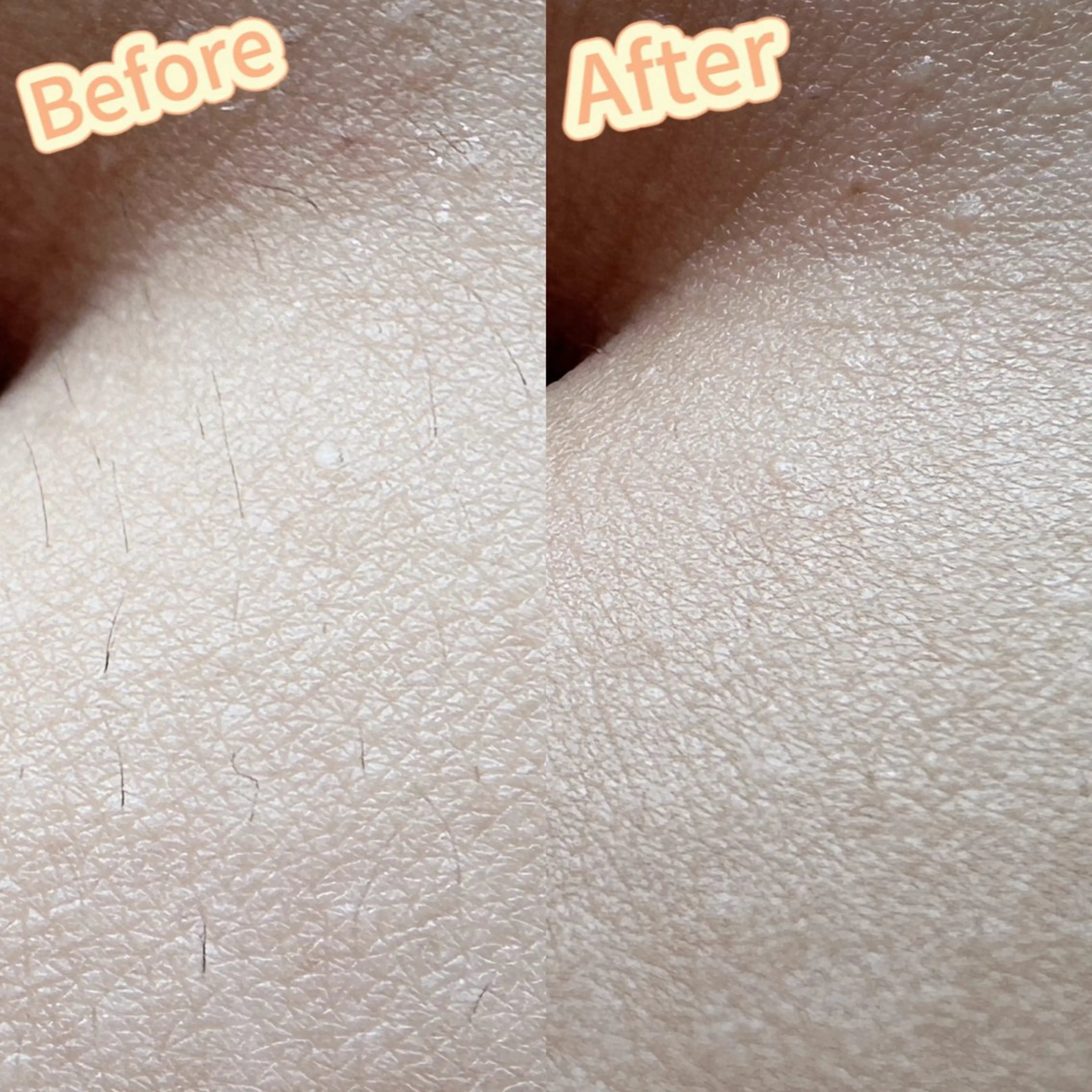 Hitomi シュガーリング豊橋のその他イメージ