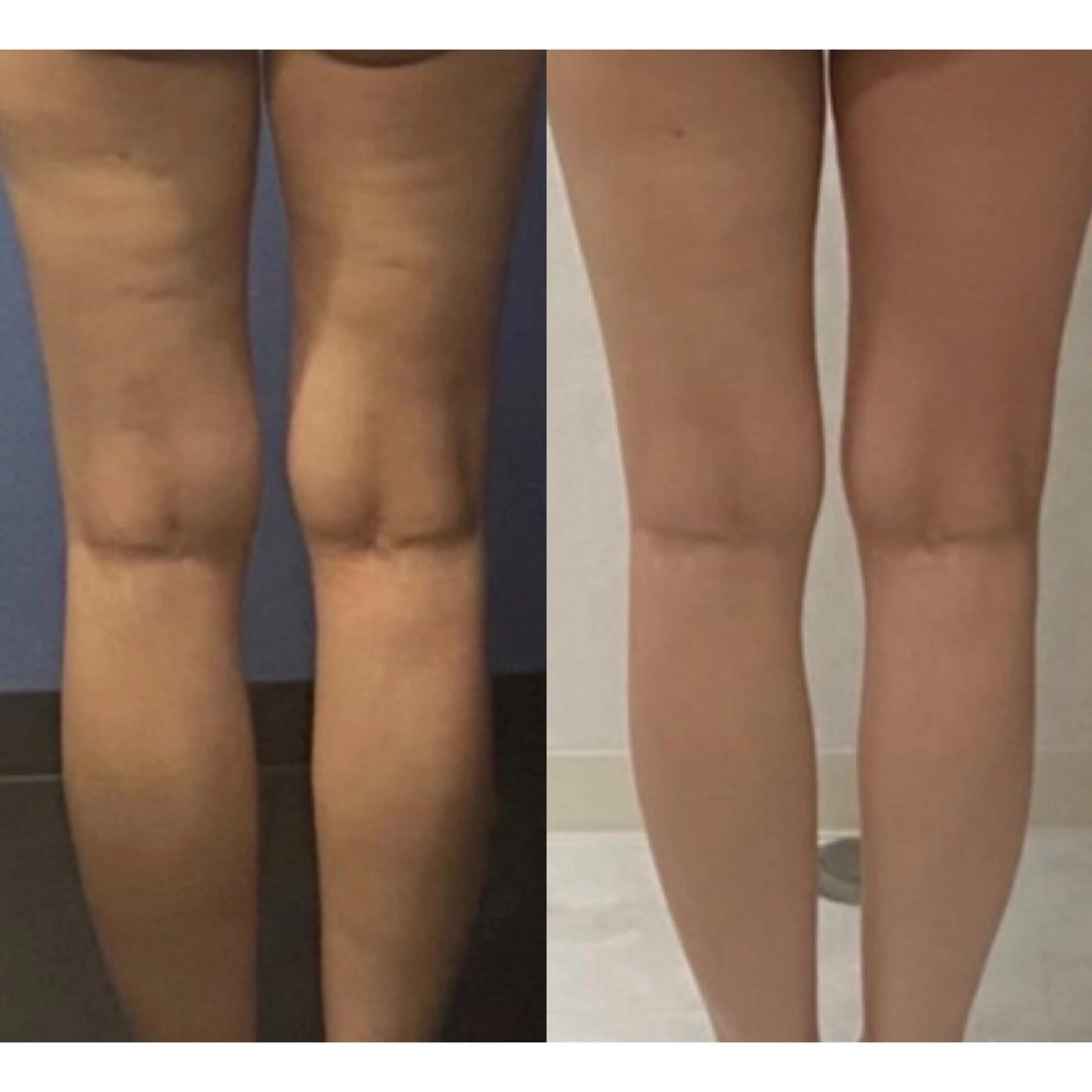 エステ B againのエステ・リラクイメージ