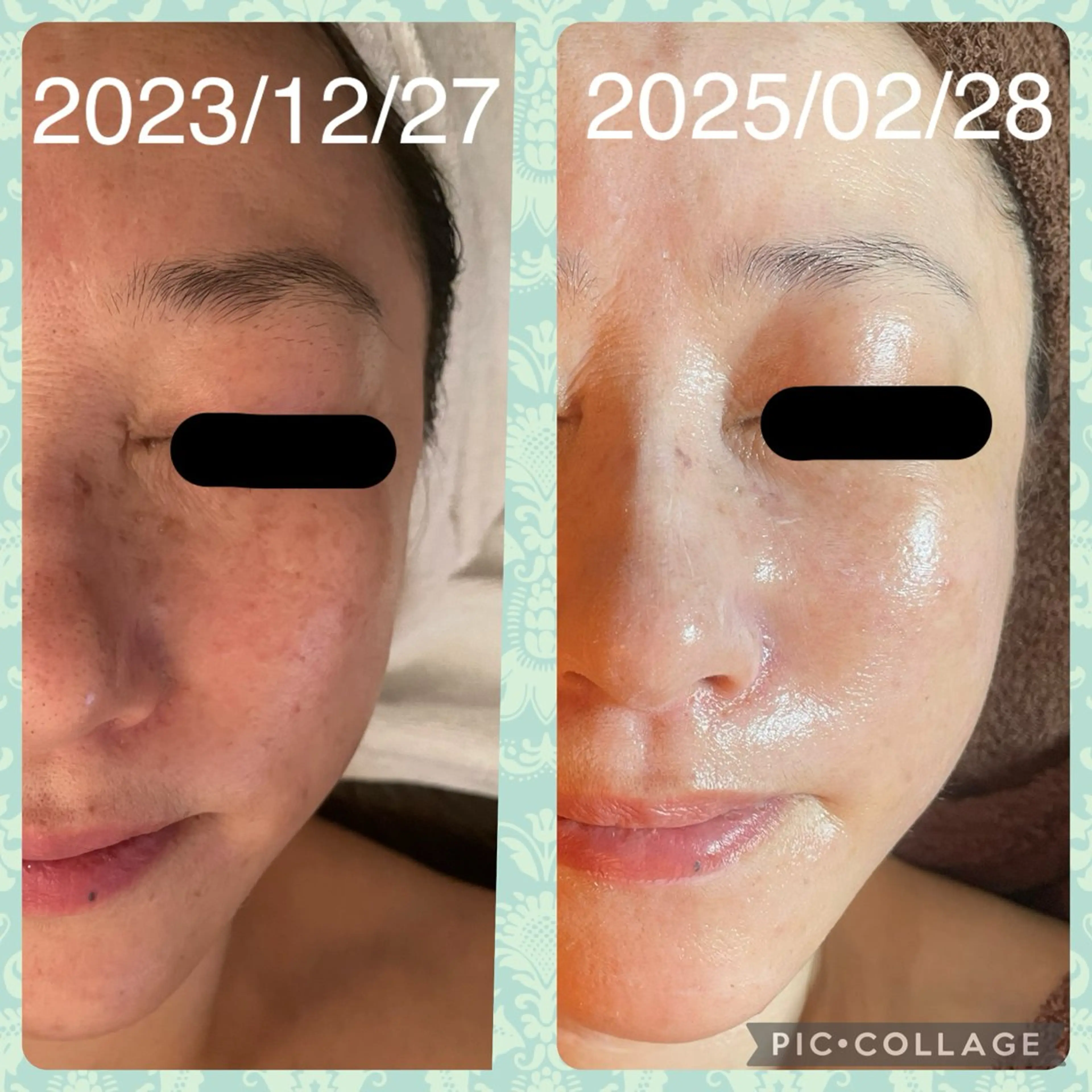 Serenity salonのエステ・リラクイメージ