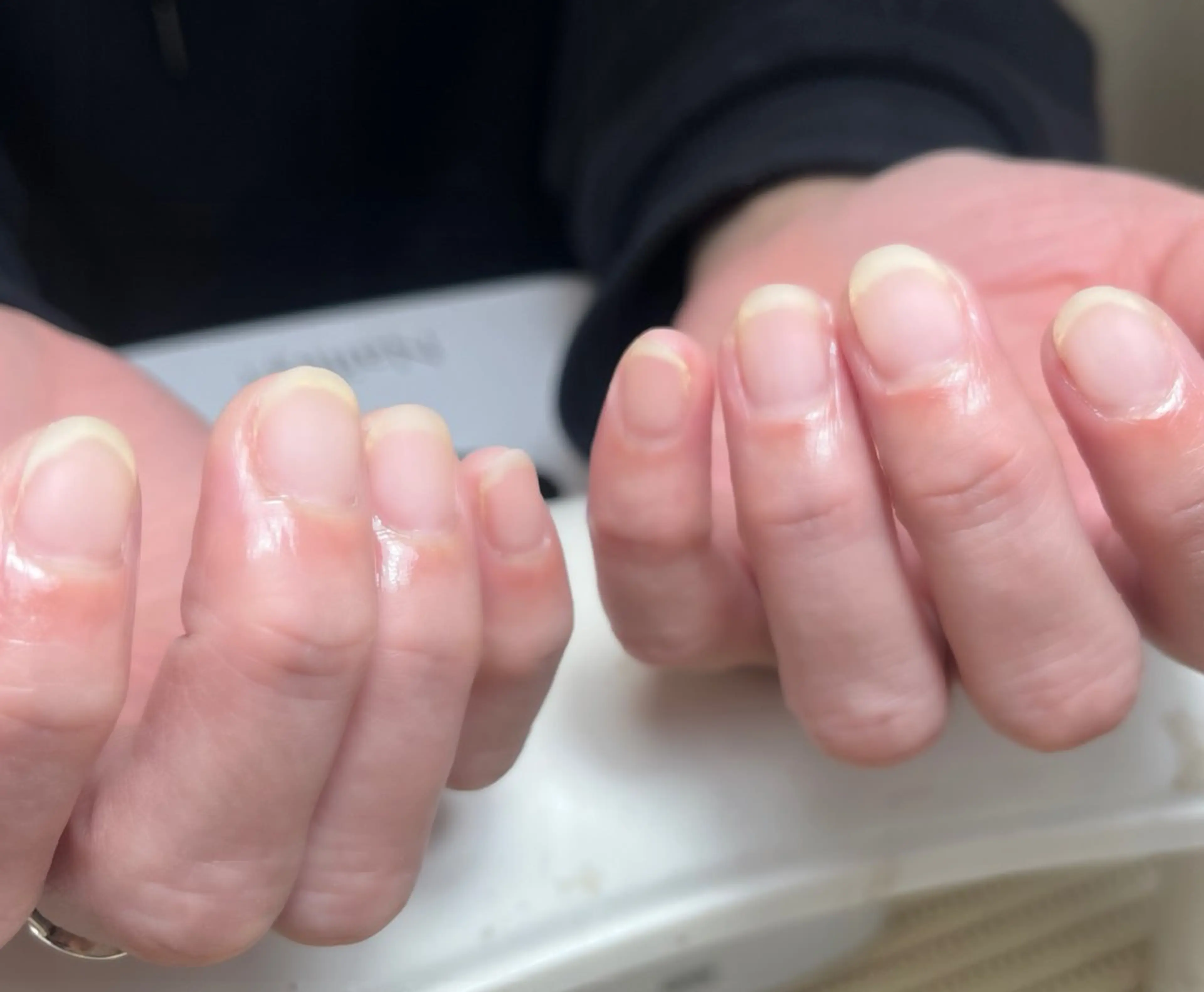 ネイル 島田 亜紀のネイルデザイン