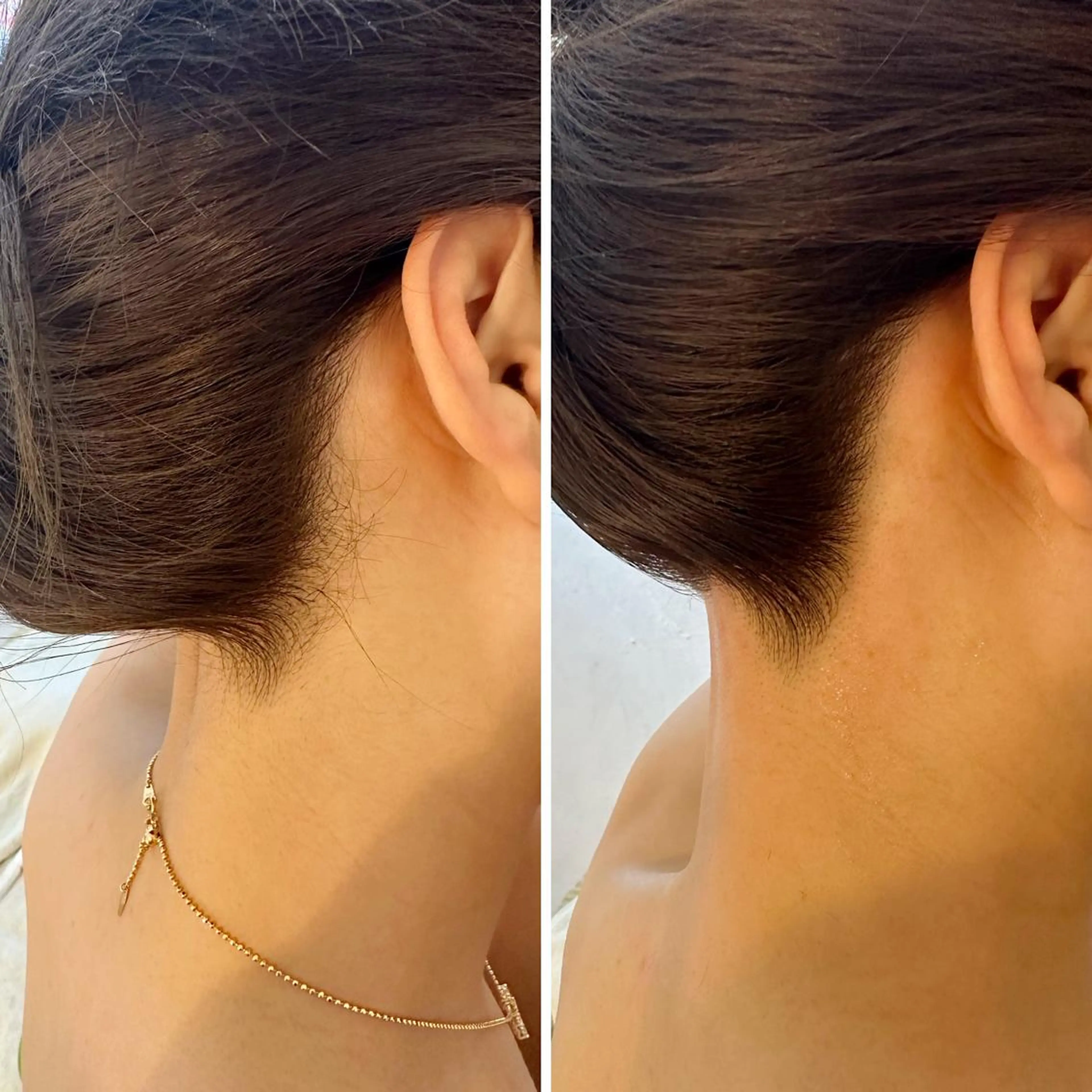 うなじ脱毛/美肌脱毛 LABELのエステ・リラクイメージ