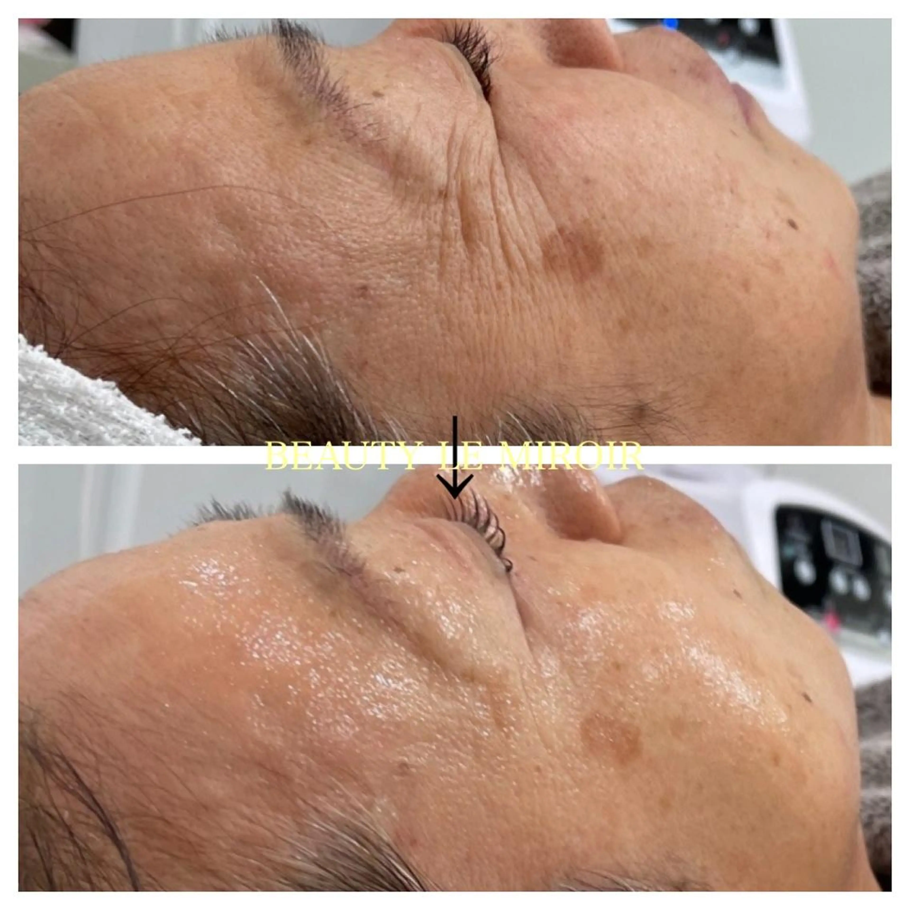 マツエク・マツパ ビューティー ミロワールのエステ・リラクイメージ