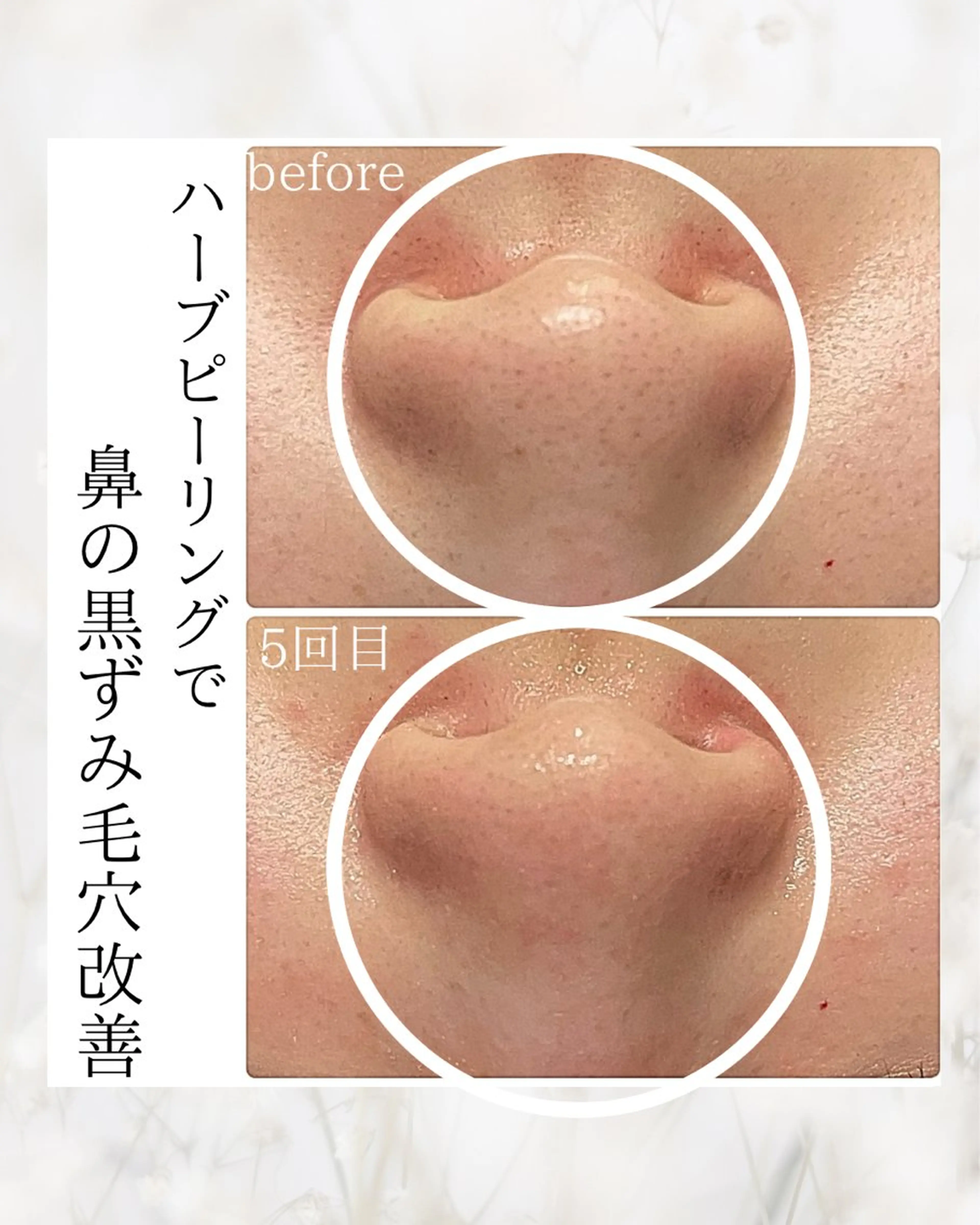 bellissimo 【ベリッシモ】所属・ちひろ　痩身/ハーブ bellissimoのエステ・リラクイメージ