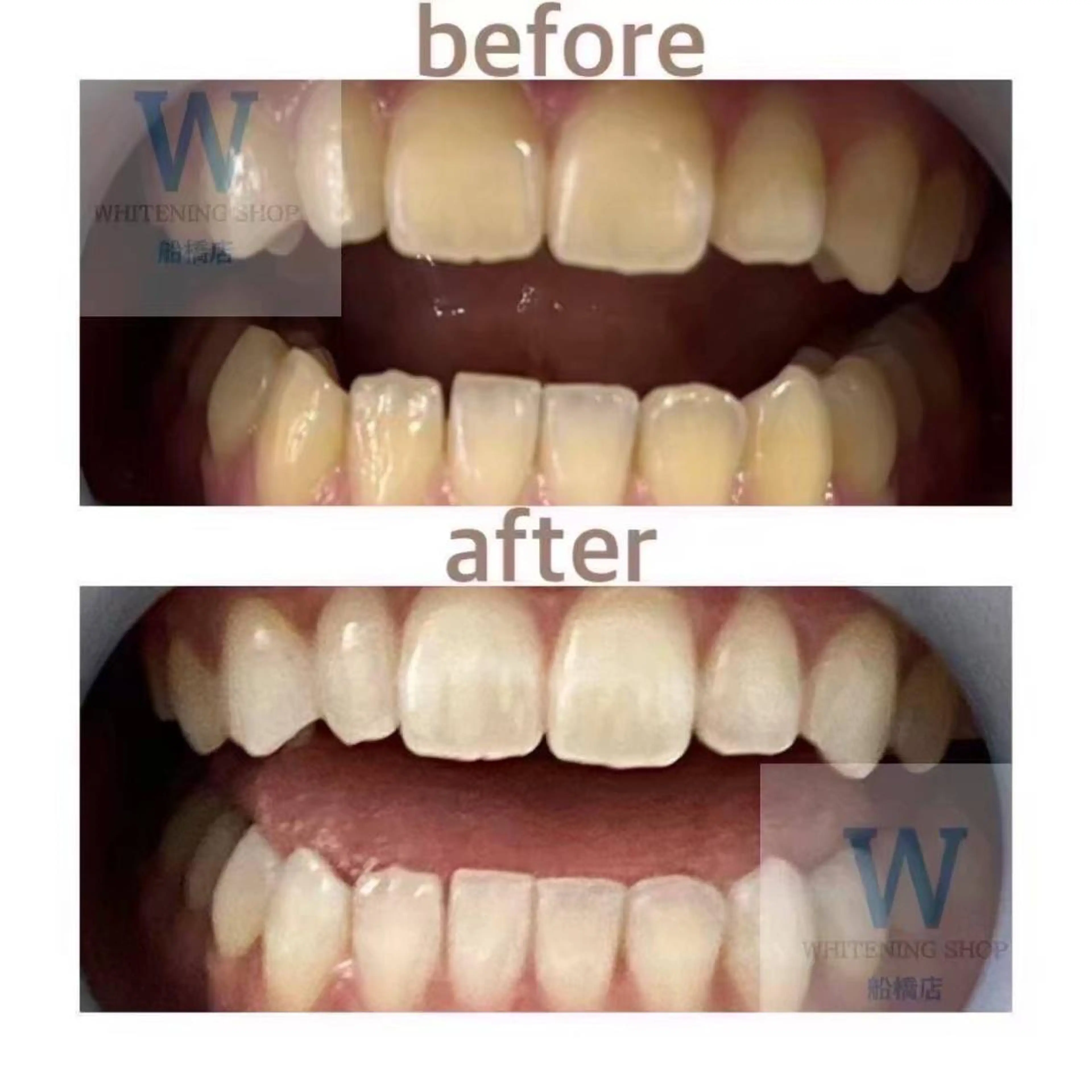 ホワイトニング ショップ船橋2号店のエステ・リラクイメージ