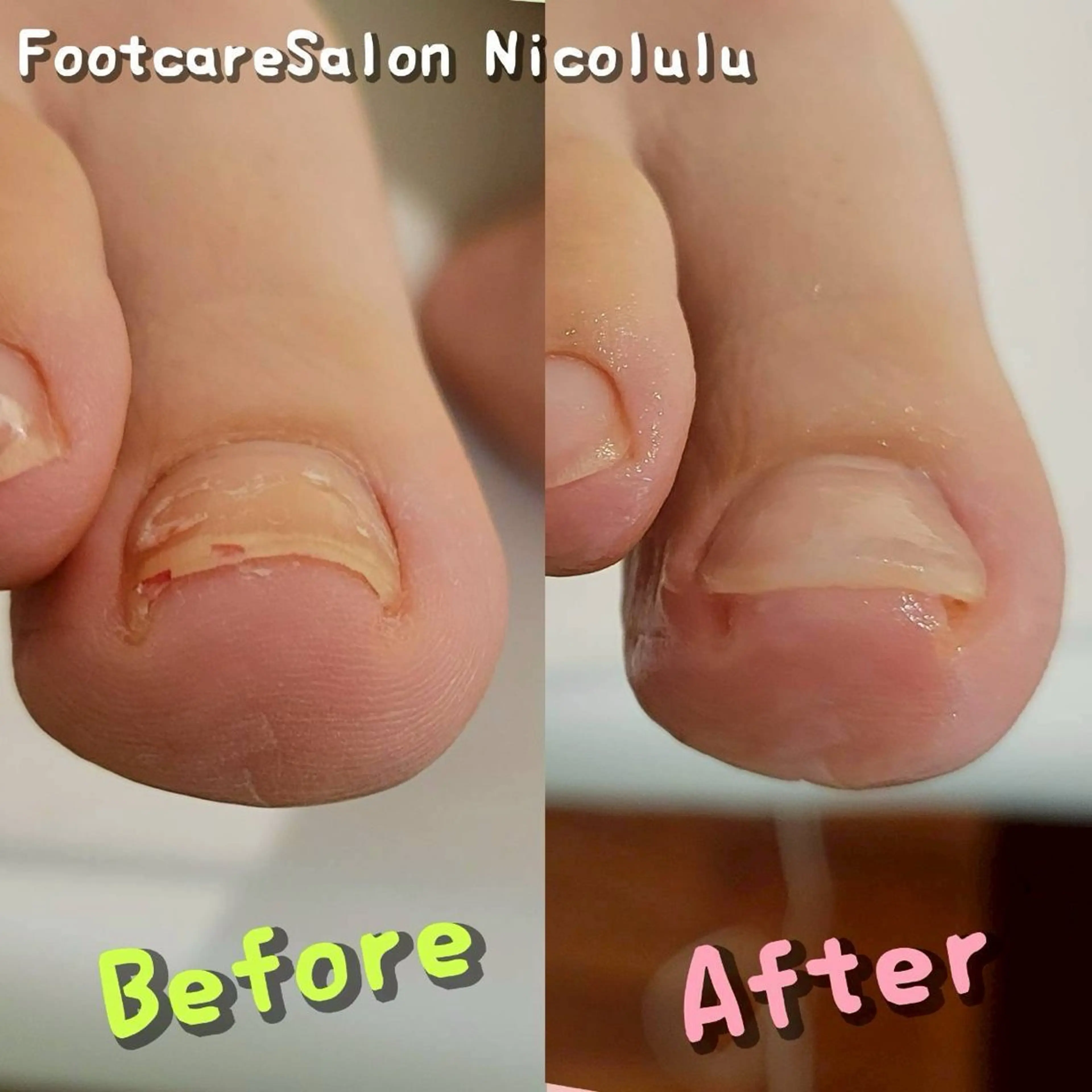 リラク 足トラブル専門 ニコルル金沢のエステ・リラクイメージ