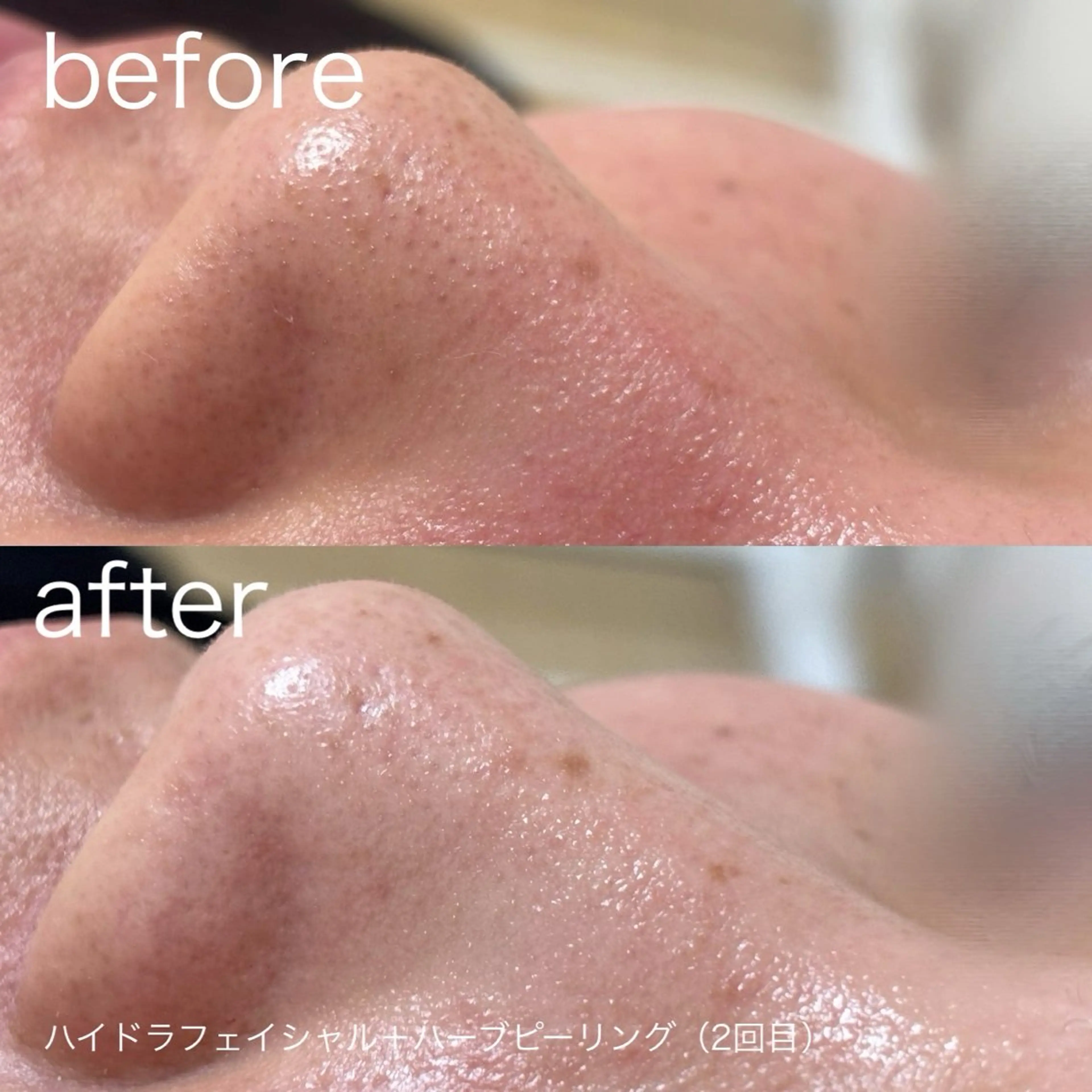 その他 lulularico Yuのエステ・リラクイメージ