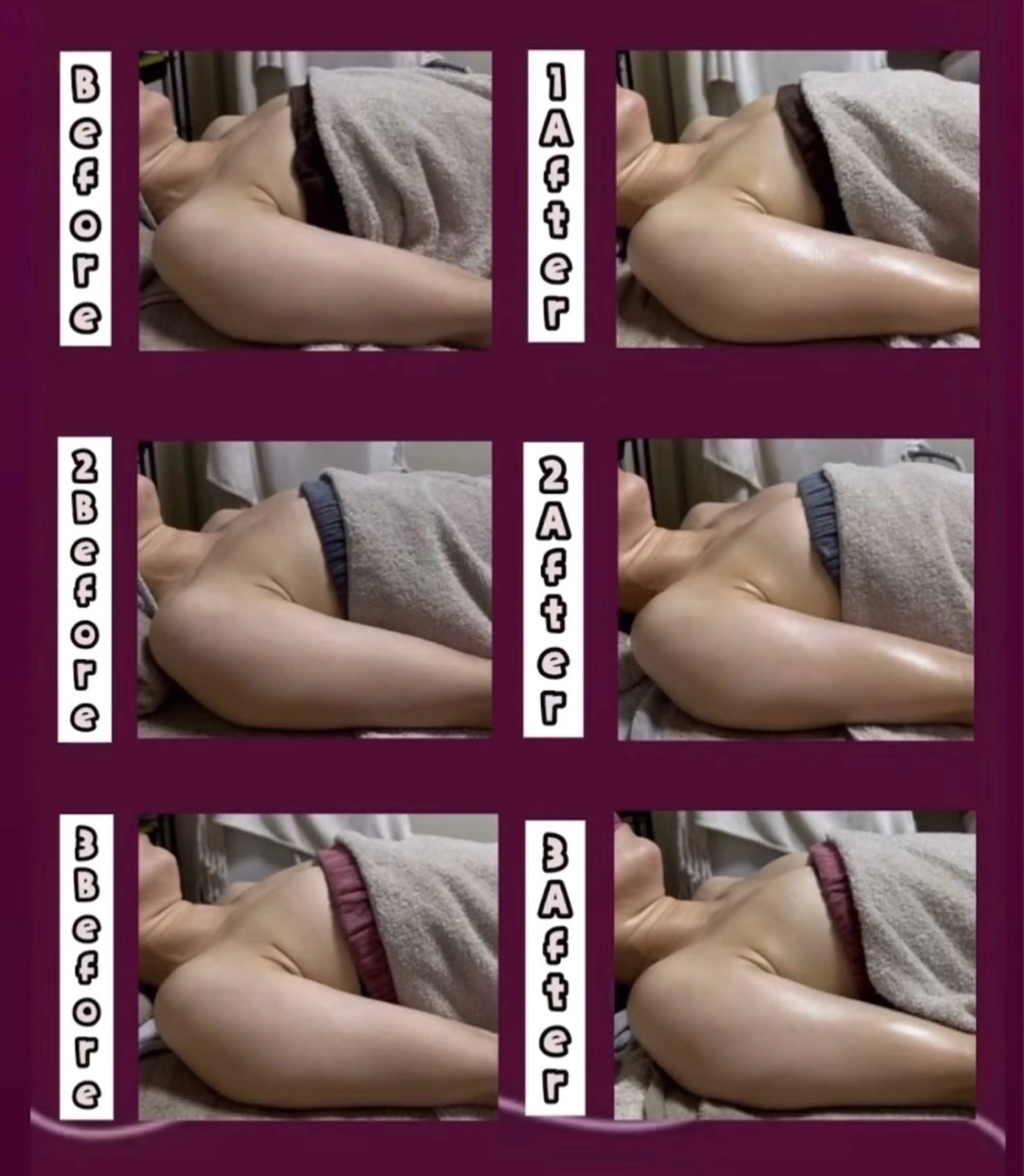 エステ ヴィーナス ビューティーのエステ・リラクイメージ