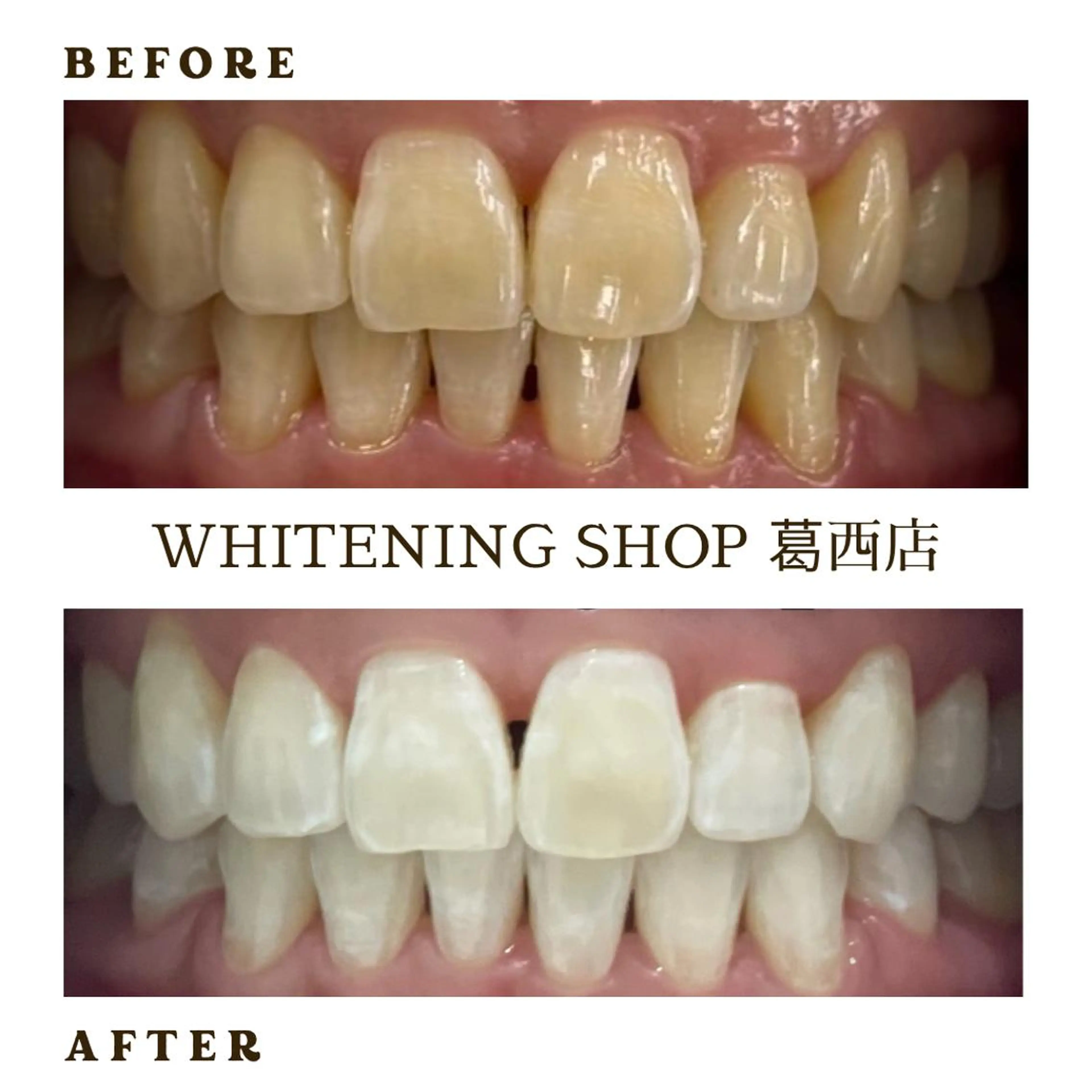 メンズ その他 ホワイトニング ショップ葛西店のその他イメージ